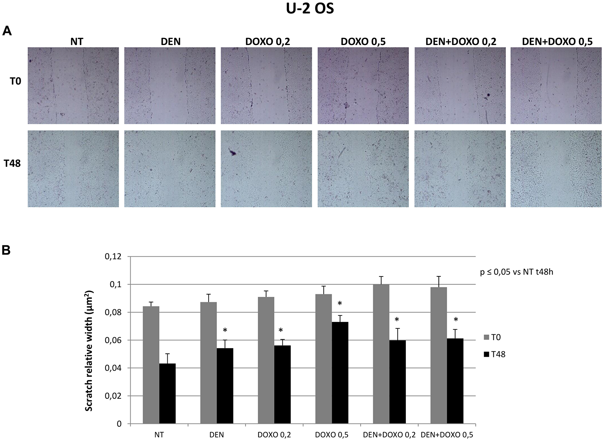 Invasive capacity evaluation in U-2 OS cells after treatment with Den and Doxo (scratch assay).