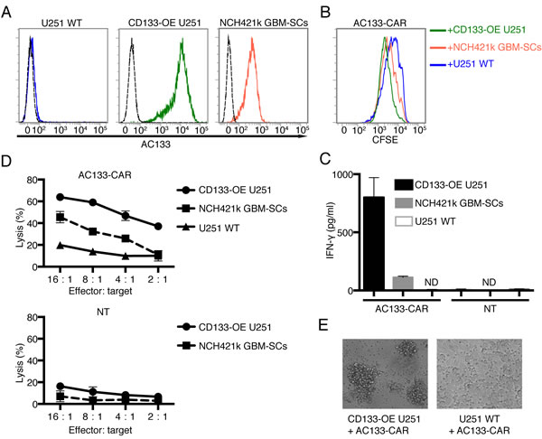 AC133-CAR T cells specifically recognize and kill AC133-positive glioma cells