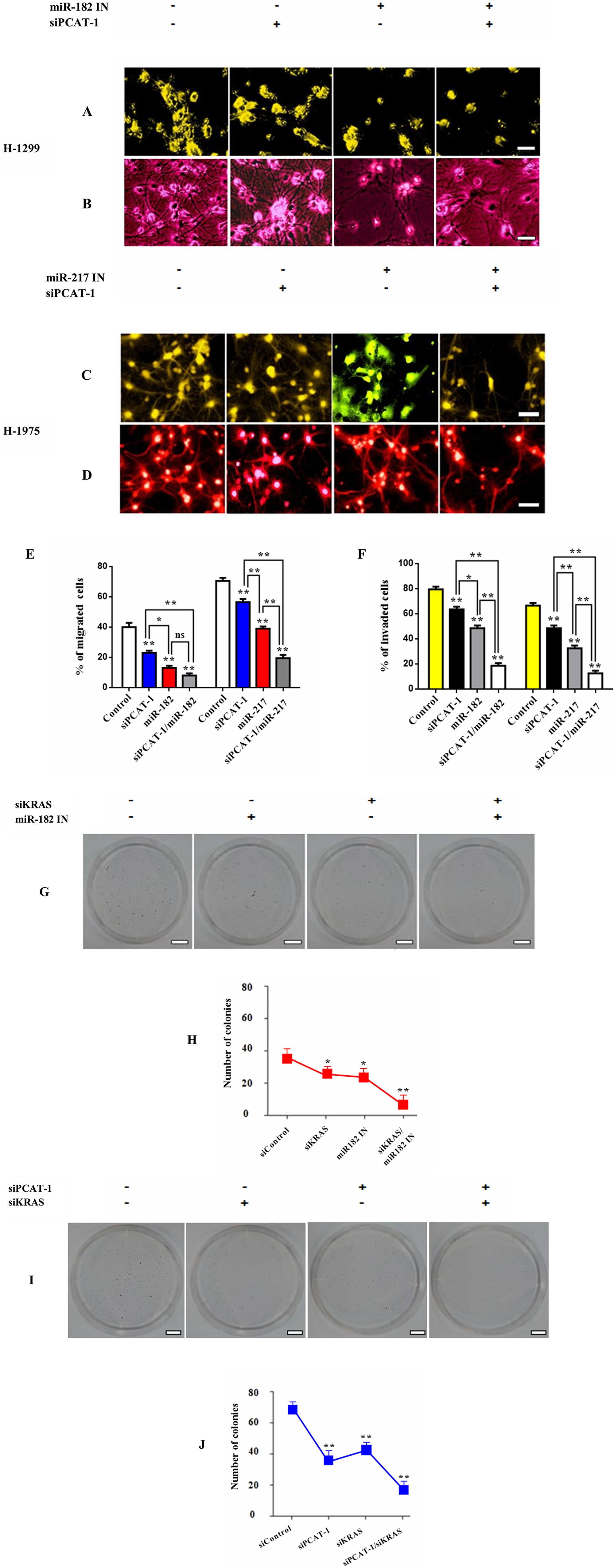 PCAT-1 regulates expression of immunosuppressive miR182/miR-217 signaling axis.