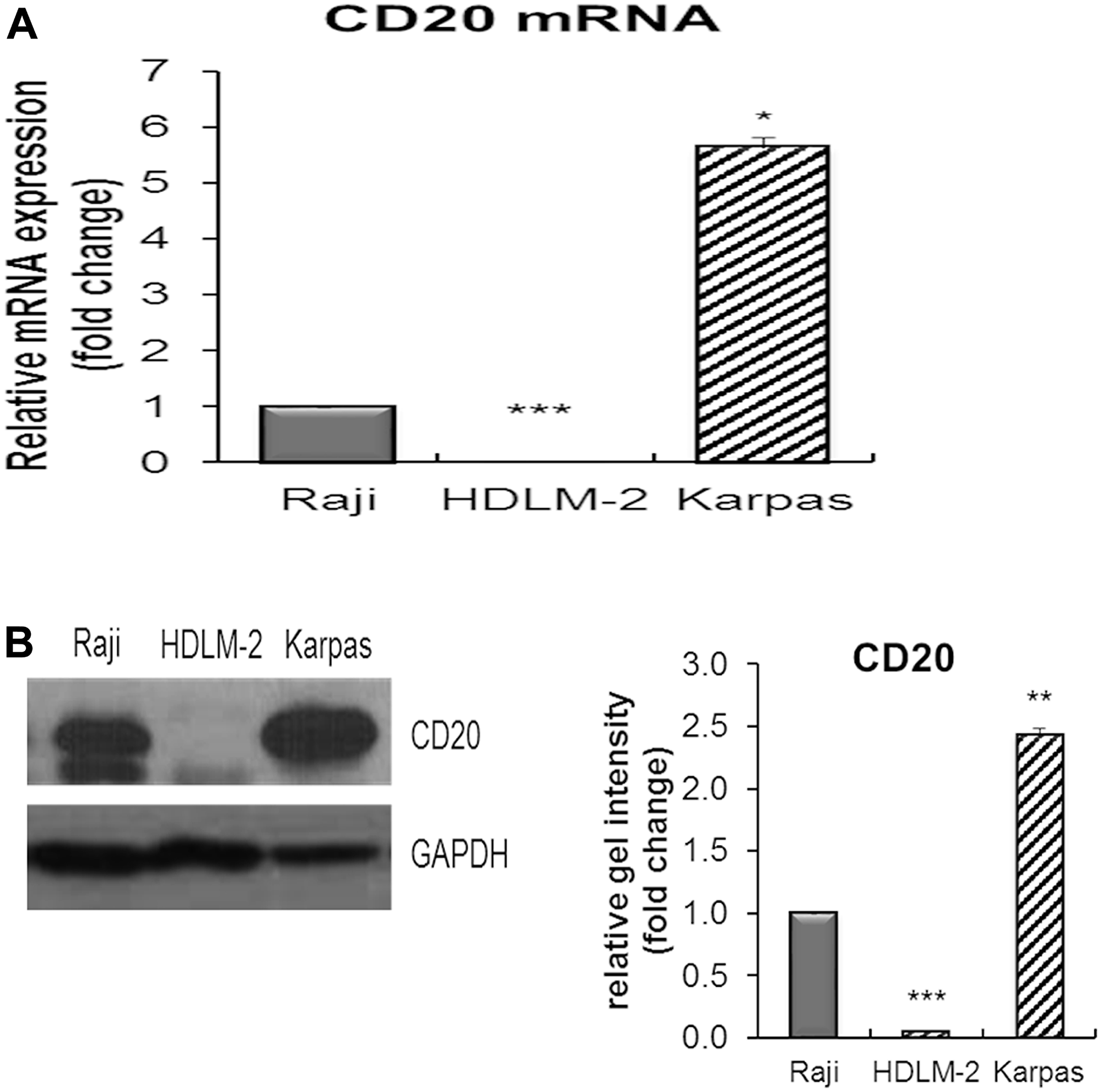 The expression of CD20 mRNA and protein in Karpas-1106 PMBL cells.