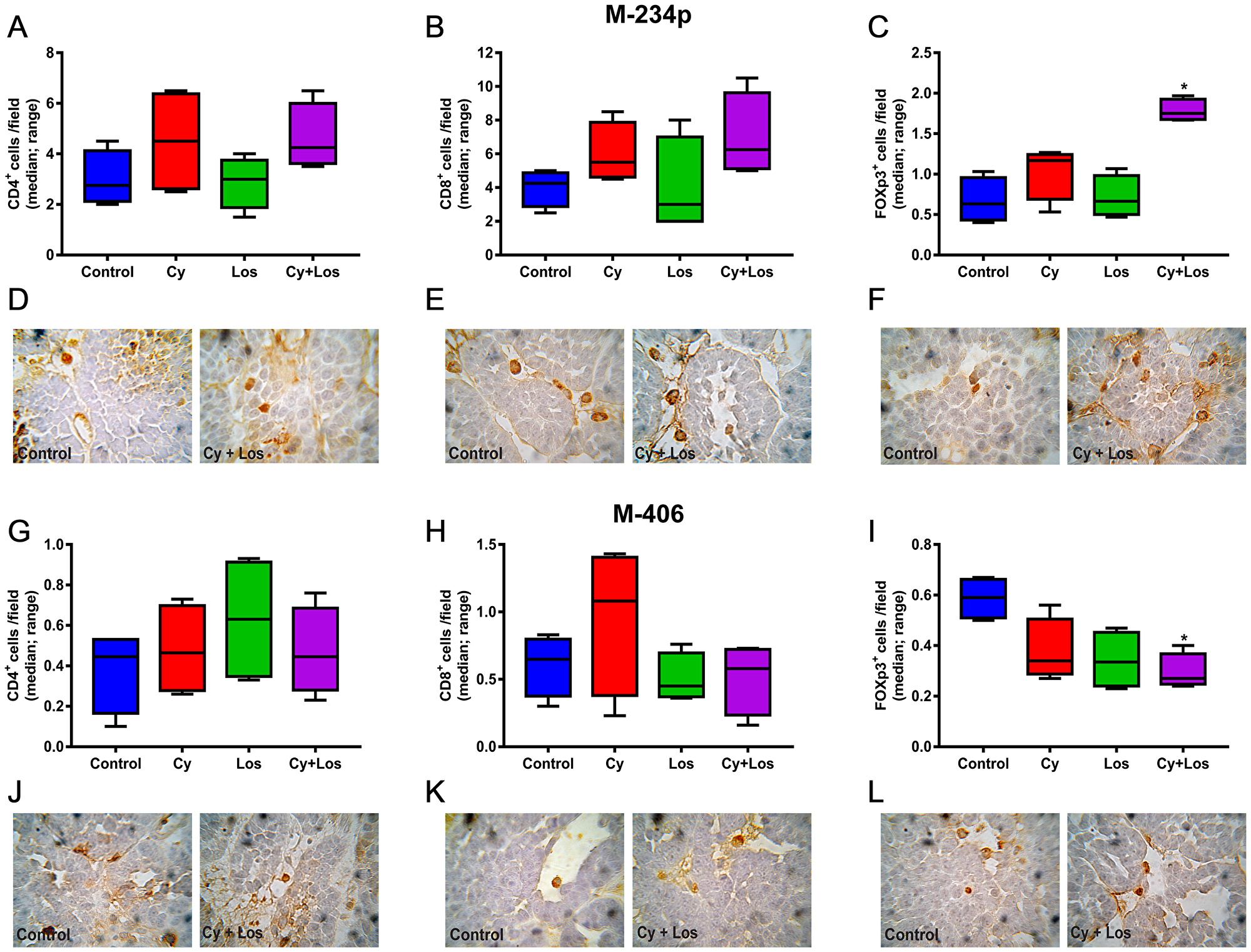 Quantification of tumor infiltrating lymphocytes by IHC.