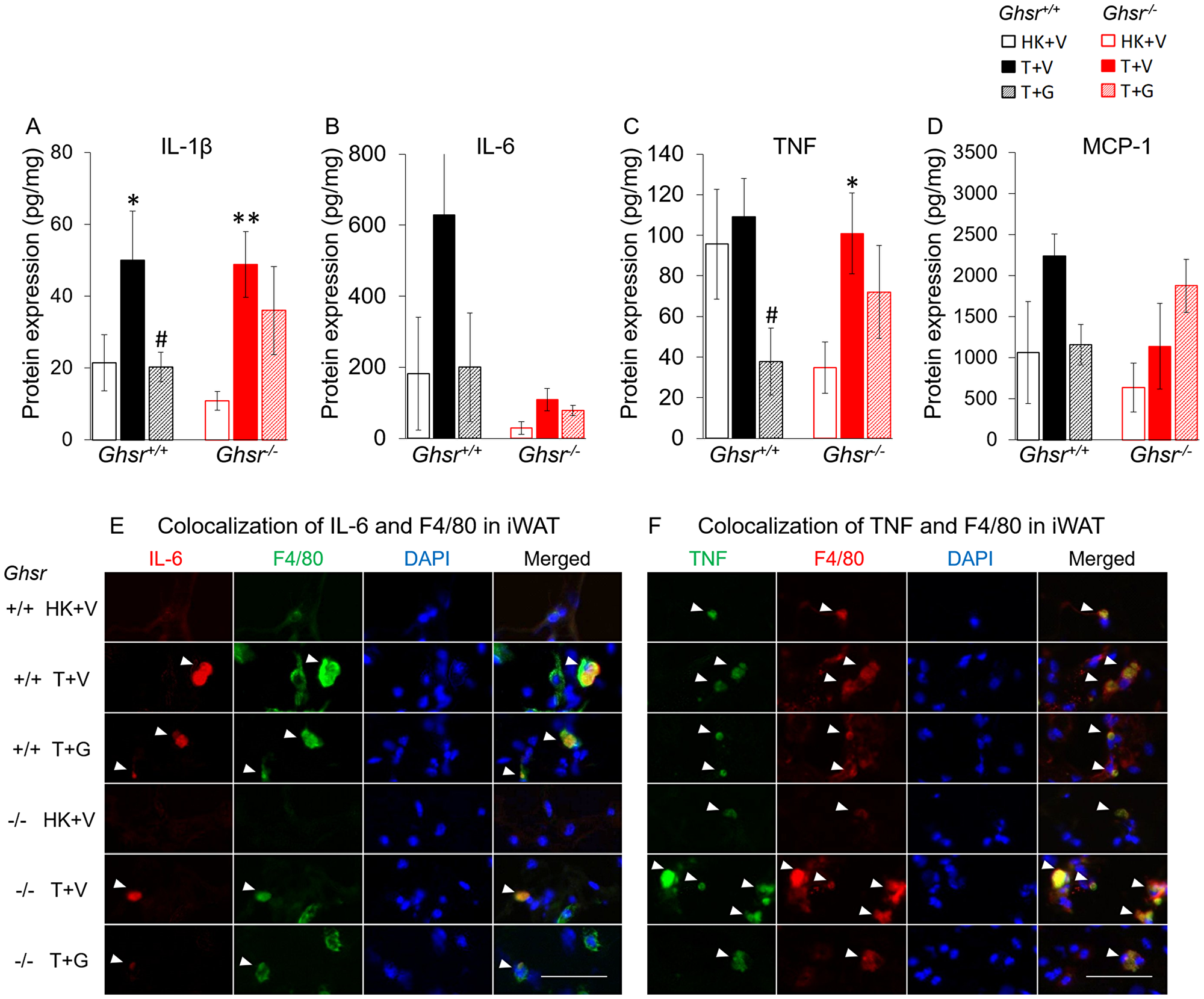 Effects of ghrelin on LLC-induced changes in inflammation and macrophages in iWAT.