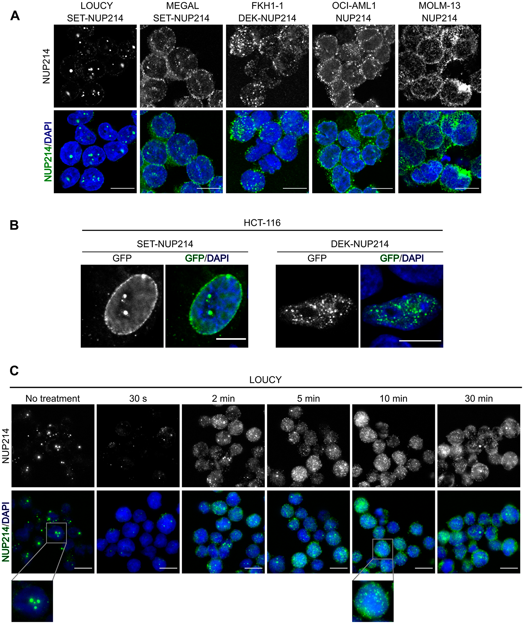 NUP214 fusion proteins localize to distinct nuclear bodies.