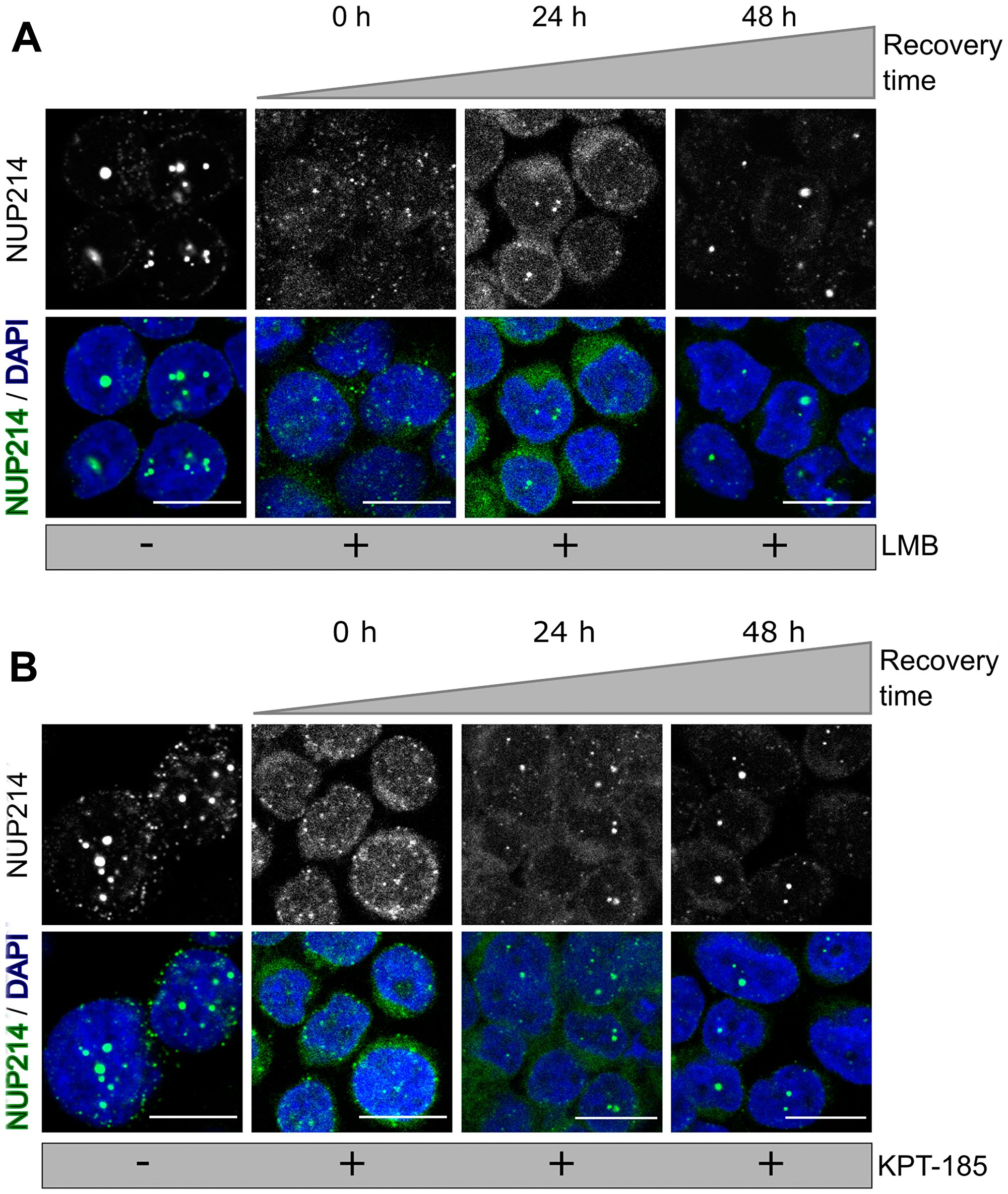 NUP214 nuclear foci reform after withdrawal of CRM1 inhibition.