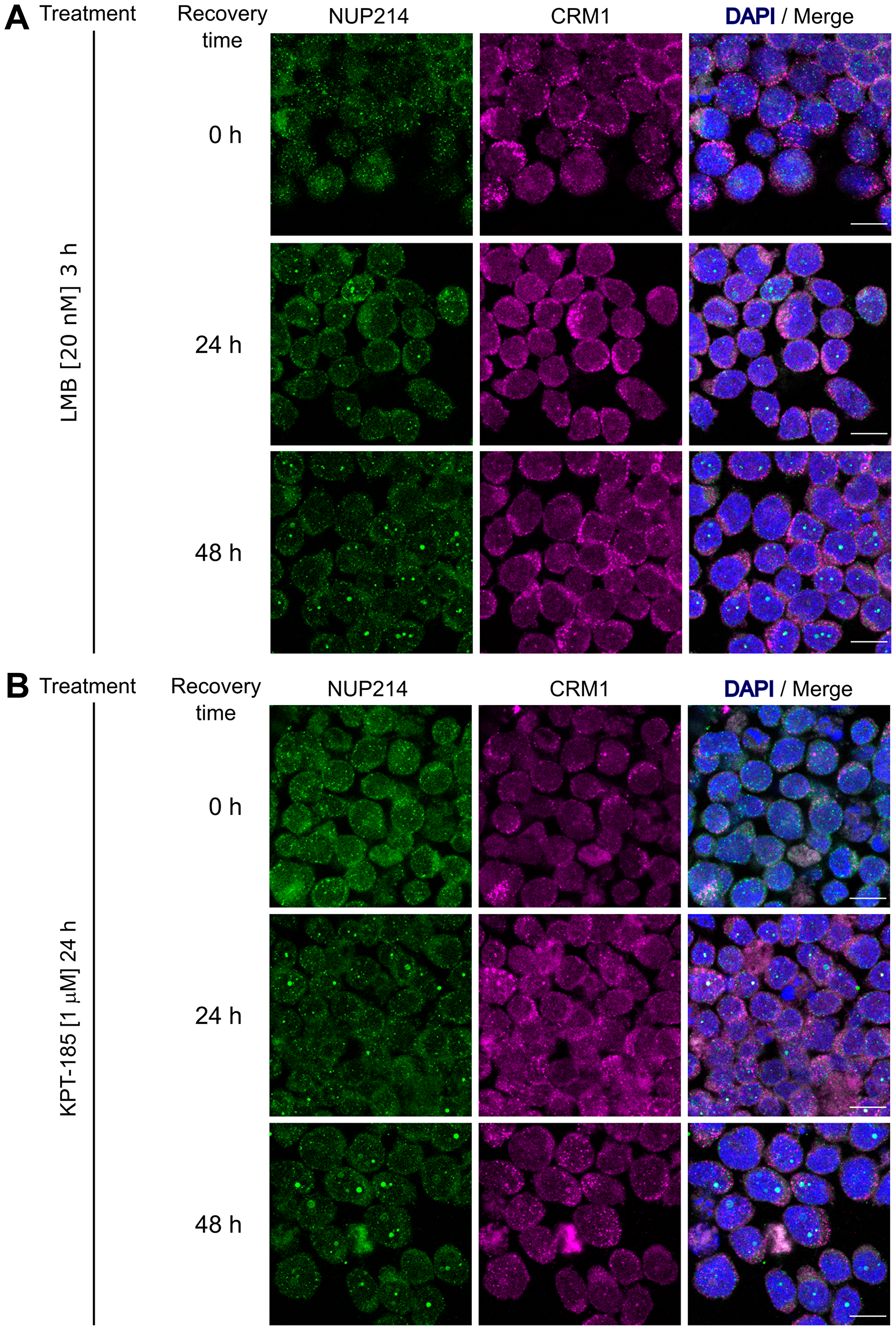 Formation of NUP214 nuclear after withdrawal of CRM1 inhibition is accompanied by CRM1 accumulation.