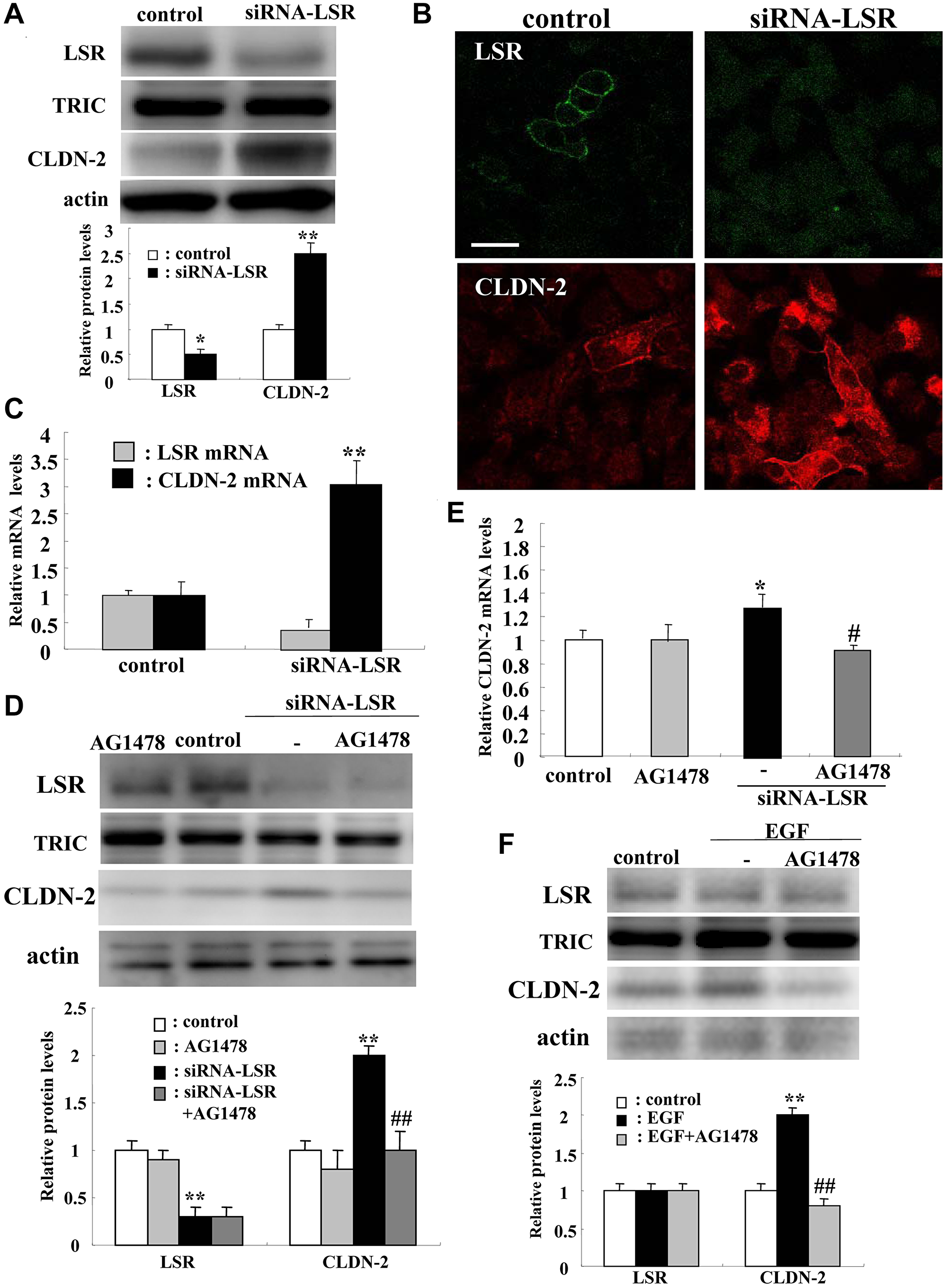 Knockdown of LSR induces CLDN-2 expression at mRNA and protein levels via EGFR signaling in human lung adenocarcinoma A549 cells.