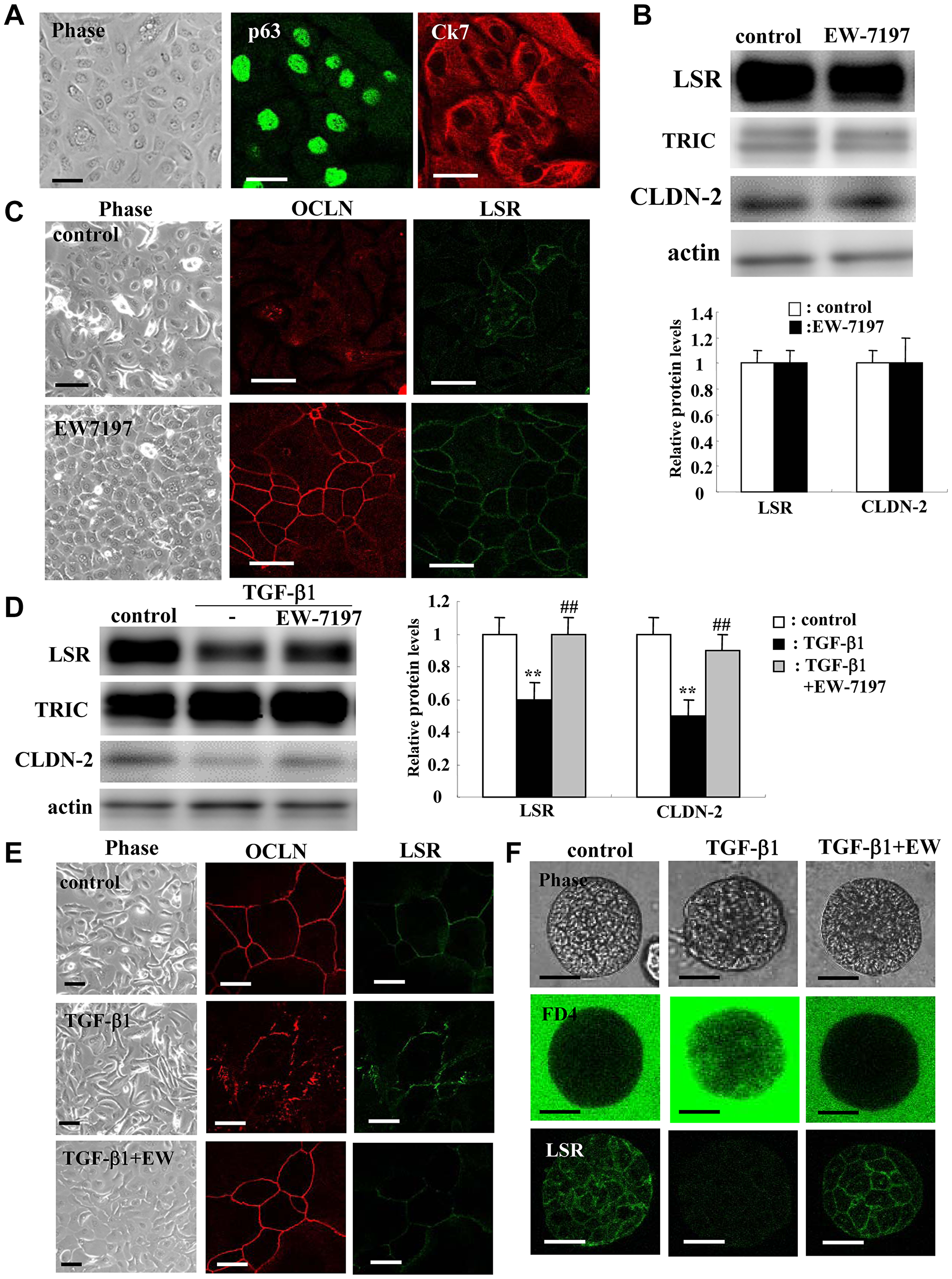 Effects of TGF-β receptor inhibitor EW7197 with and without TGF-β1 for LSR, TRIC, OCLN, and CLDN-2 in human lung epithelial cells (HLE) cells with and without 10% FBS.