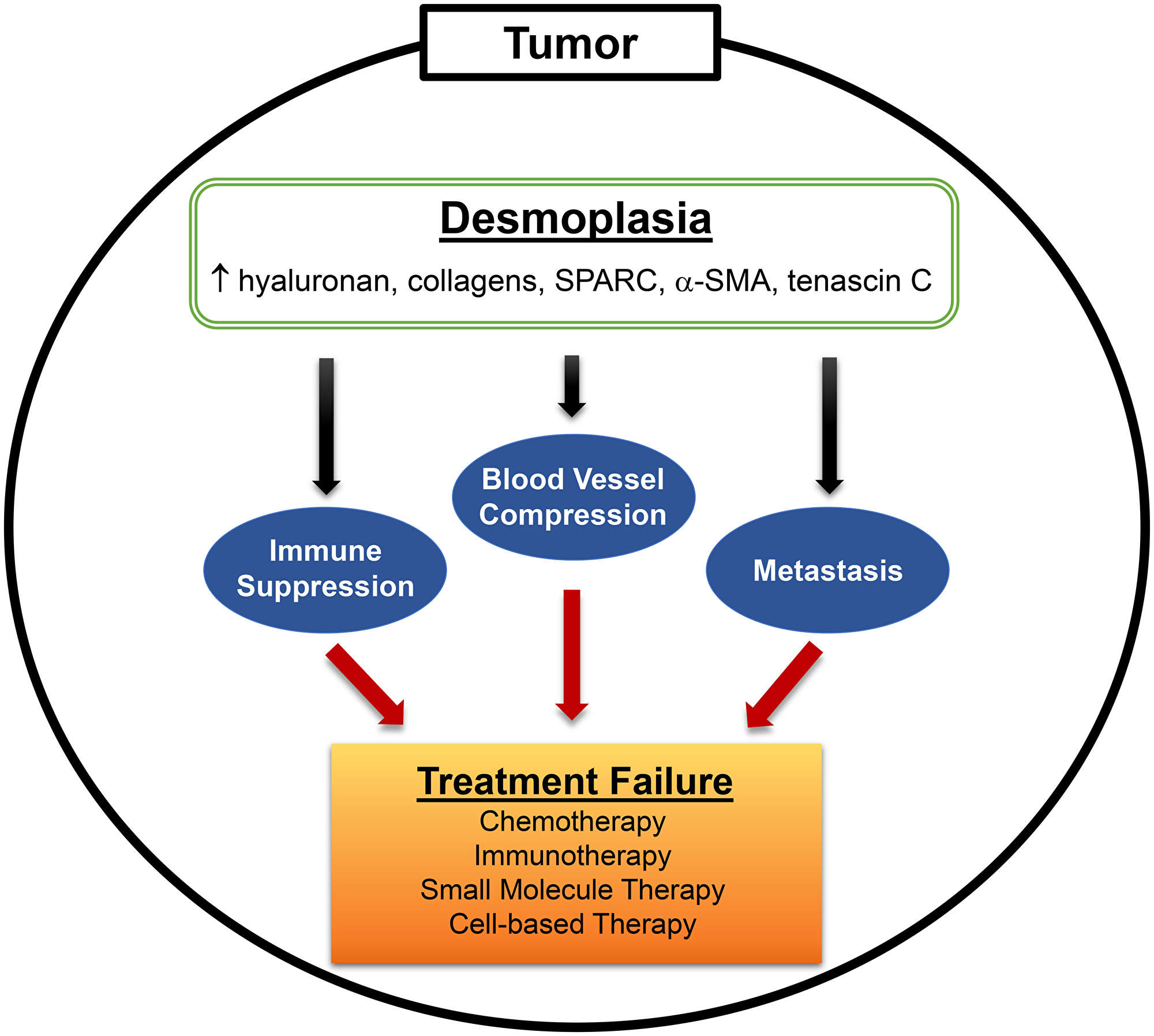 Desmoplasia is a major hallmark of PDAC.