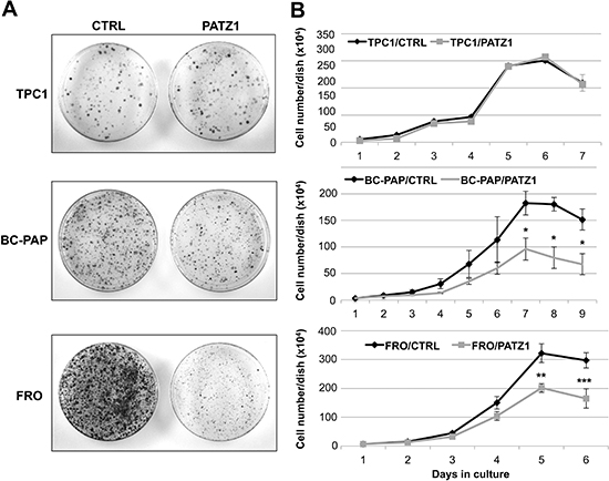 Analysis of cell growth in PATZ1-transfected thyroid cancer cells.