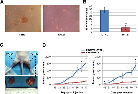 PATZ1 inhibits in vitro and in vivo tumorigenicity in FRO cells.
