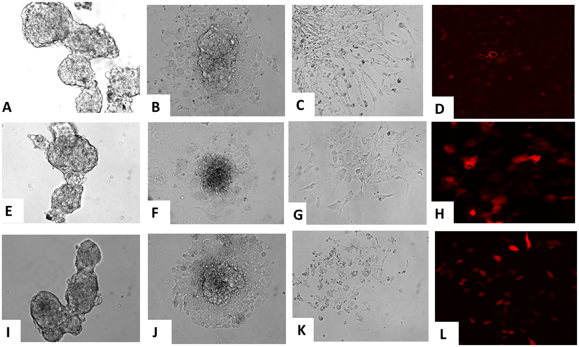 Pluripotent differentiation of iPSC clones in vitro.