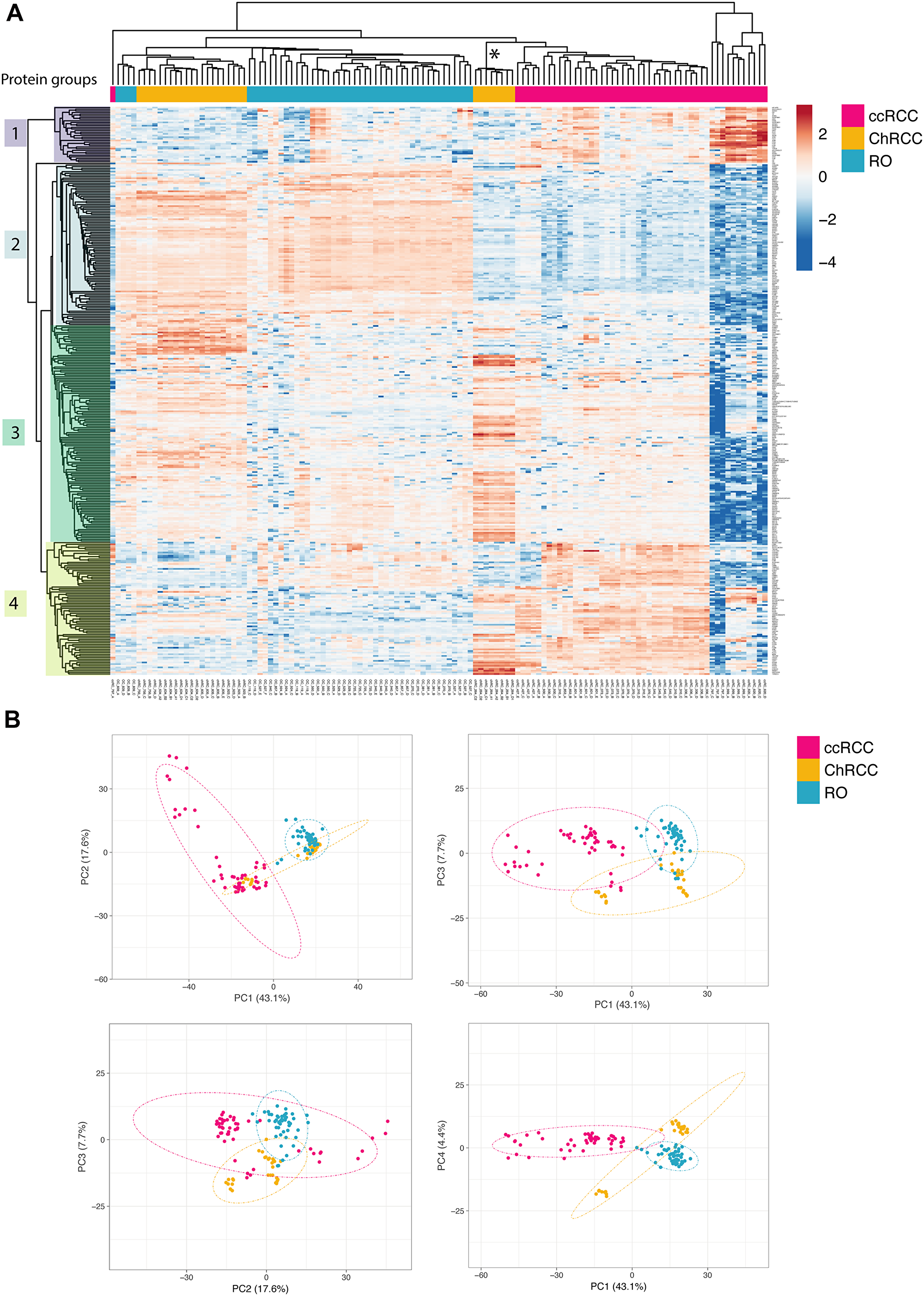 Unsupervised renal cancer subtype classification by microproteomics using rapid LC-MS/MS protein profiling.