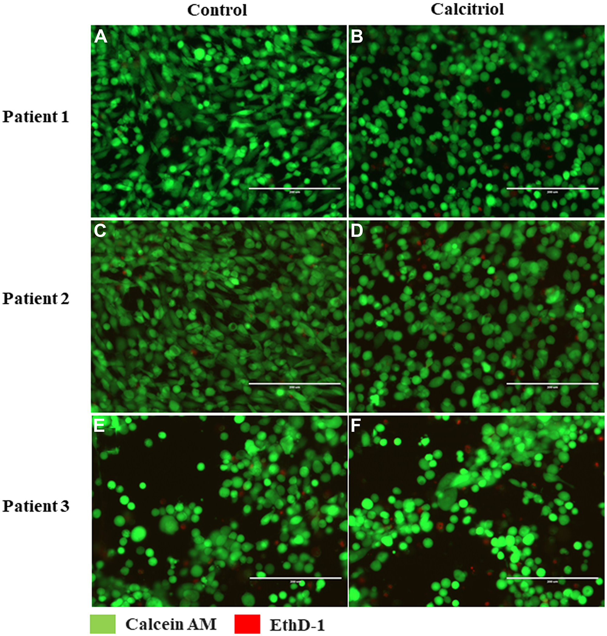 Vitamin D-regulated viability of cultured ovarian surface epithelial (OSE) cells.