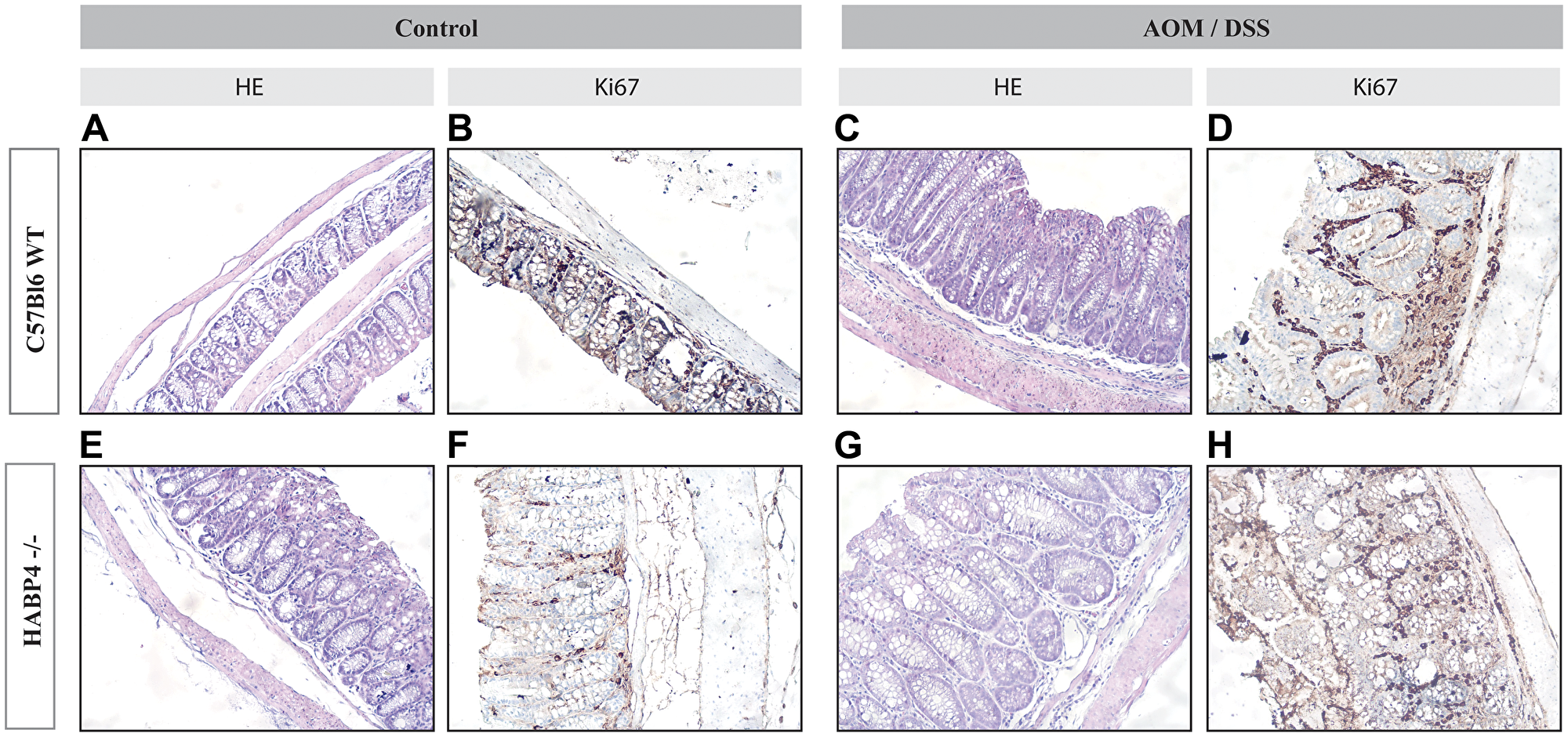 Histological sections of colon tissues of wild-type and Habp4 –/– mice.