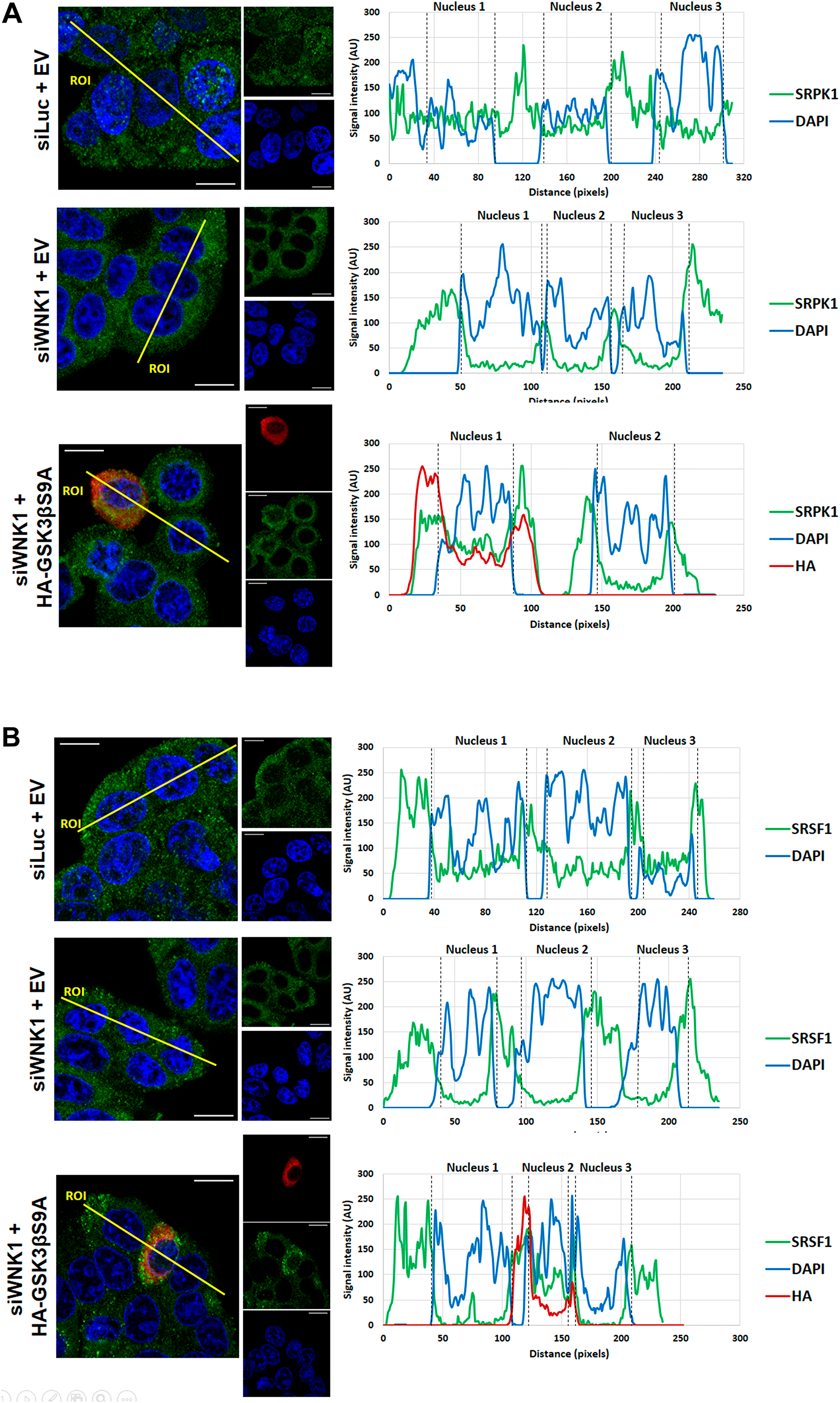 Effect of WNK1 depletion on SRPK1 and SRSF1 subcellular localization.