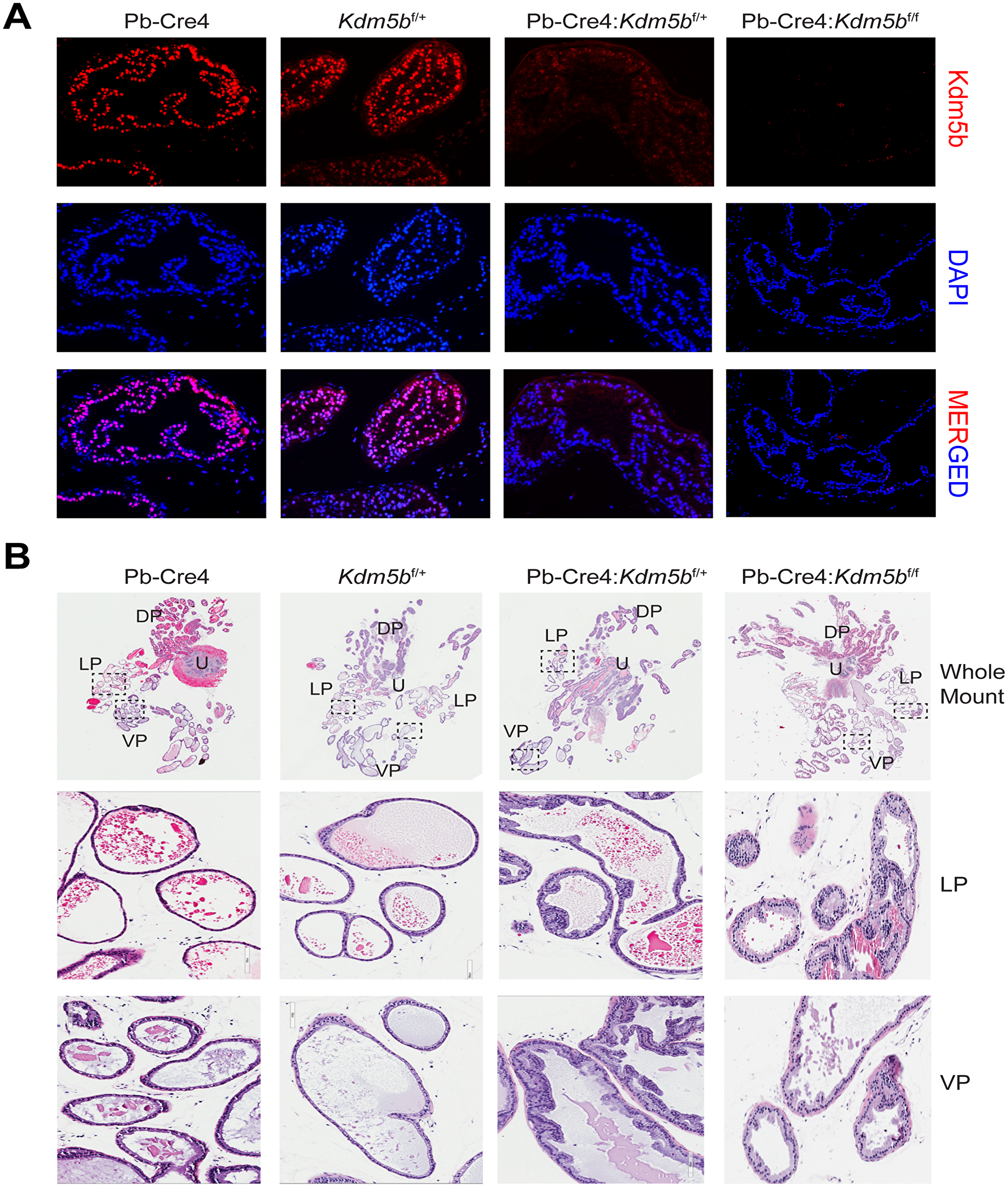 Kdm5b deficient mouse prostates manifest low-grade hyperplasia.