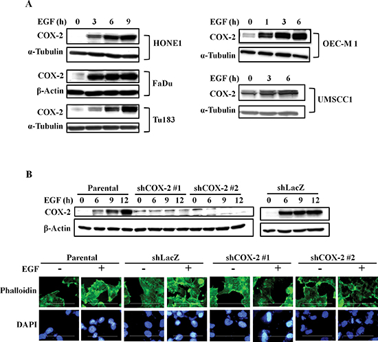 EGF induces COX-2 expression and morphological changes in HNSCC cells.