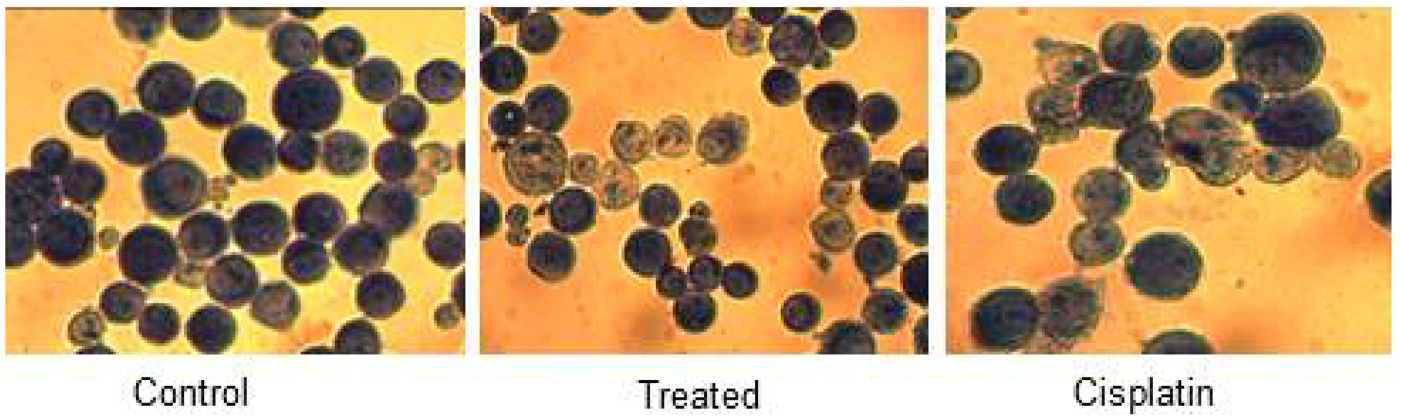 HeLa control, treated and cisplatin treated cells in d1 were fixed and stained with Giemsa and visualized under light magnifying lens and captured.