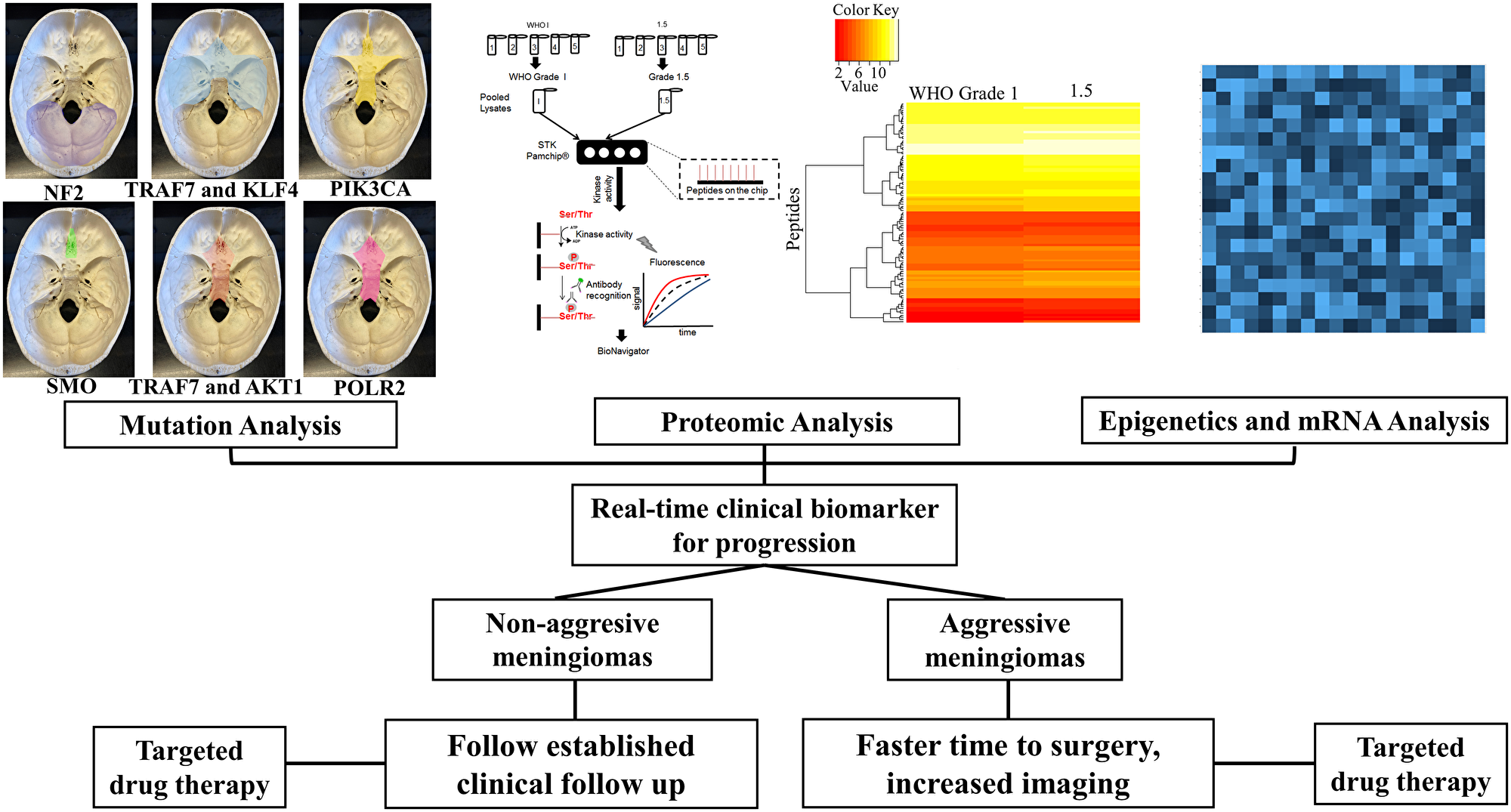 Multi-pronged approach for meningioma therapy.