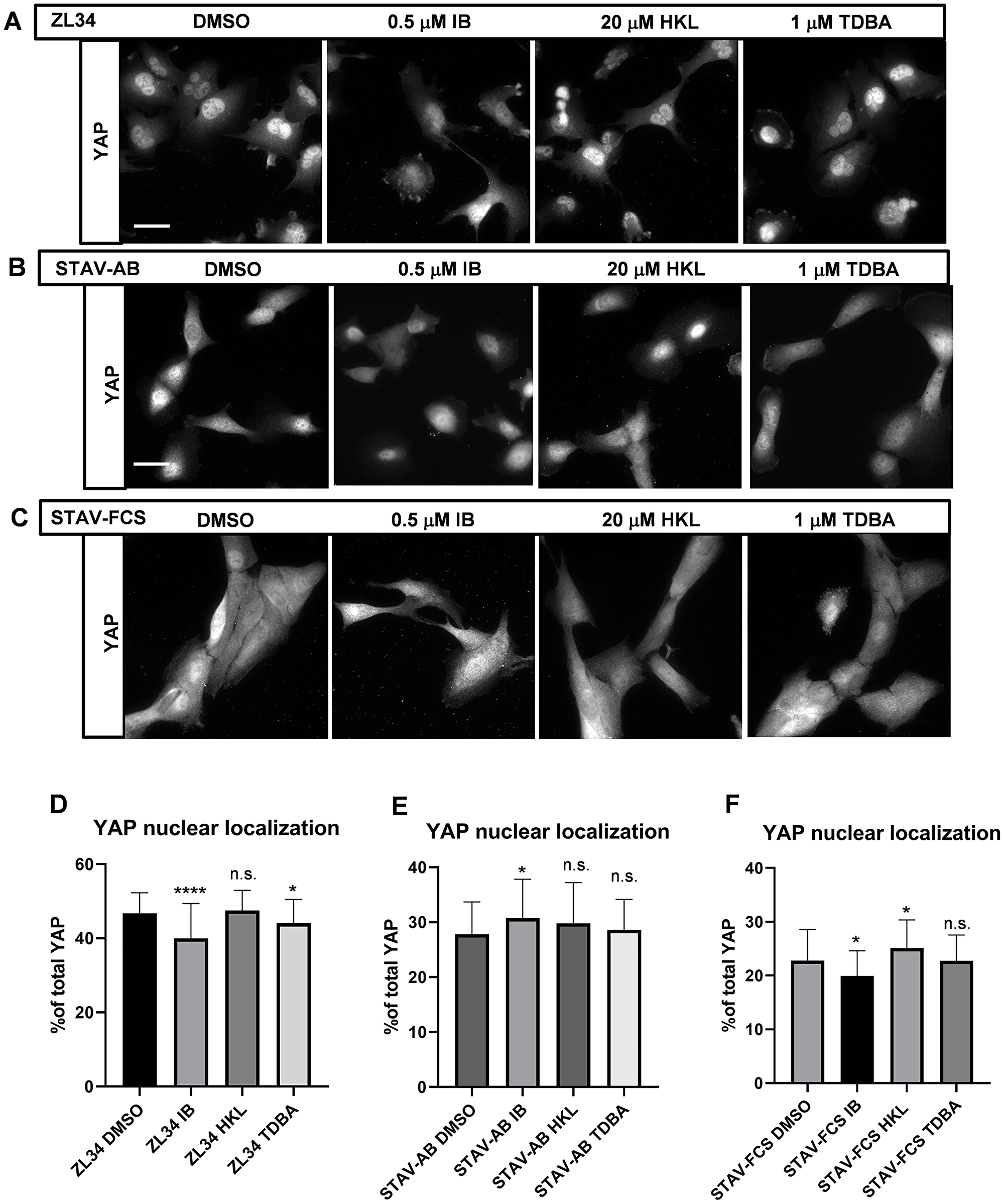 Effects of the inhibitors on the YAP nuclear localization.