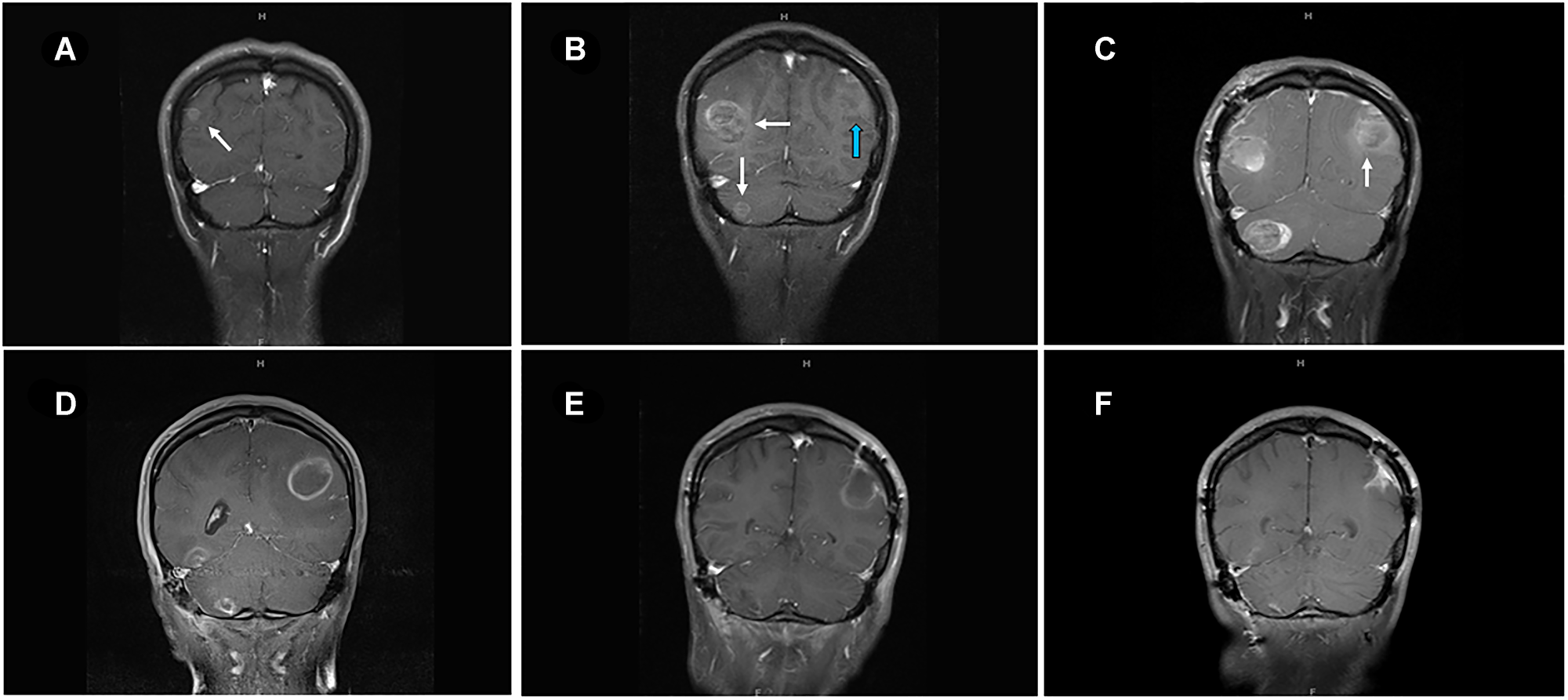 Figure 2: