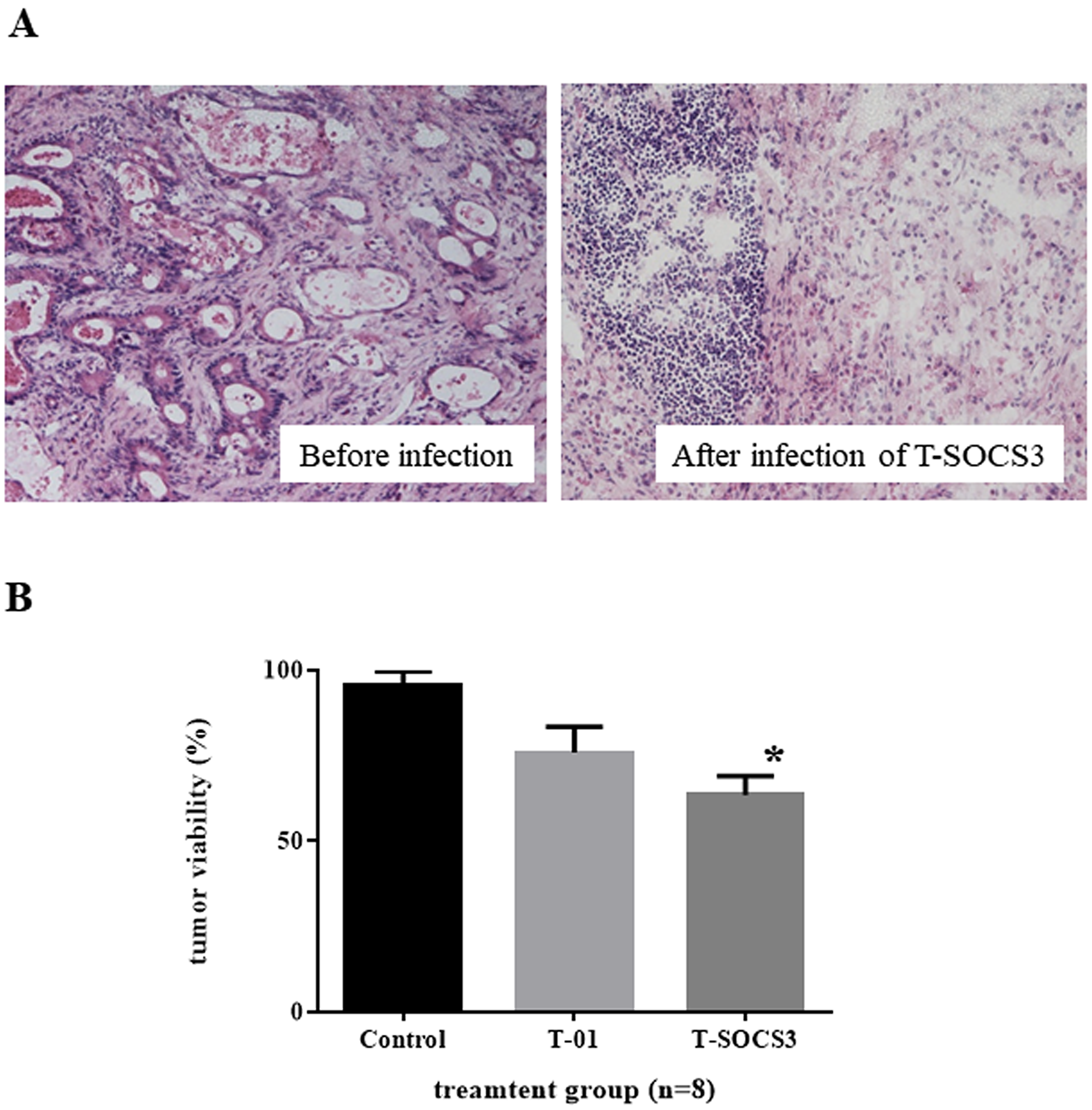 Ex vivo assessment of oncolytic herpes simplex virus killing effect in gastric cancer.