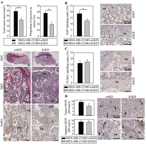 &#x3b2;1 integrins promote tumor growth in bone by increasing cell proliferation