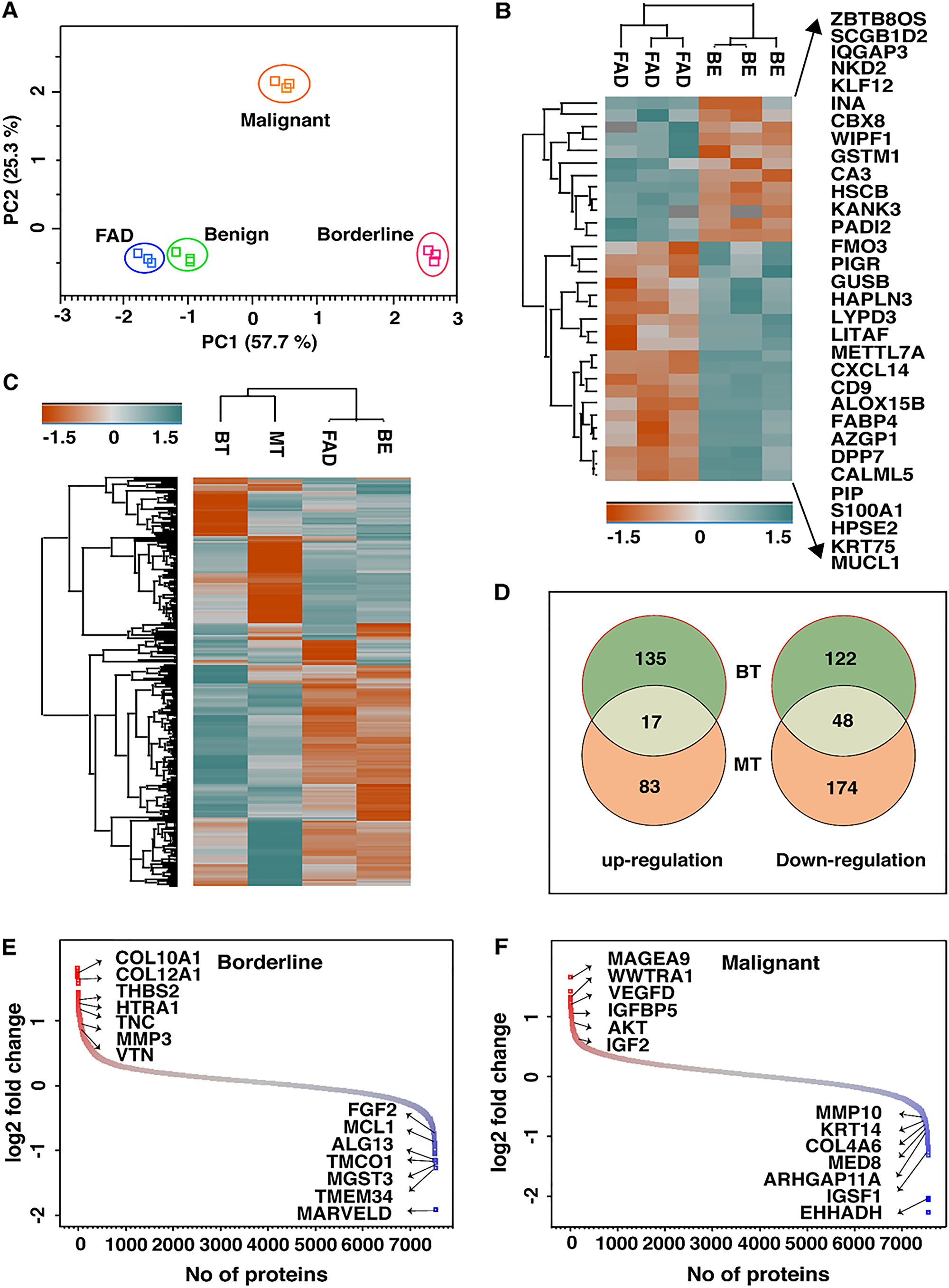 Quantitative Proteome Profiling Stratifies Fibroepithelial Lesions Of The Breast Oncotarget