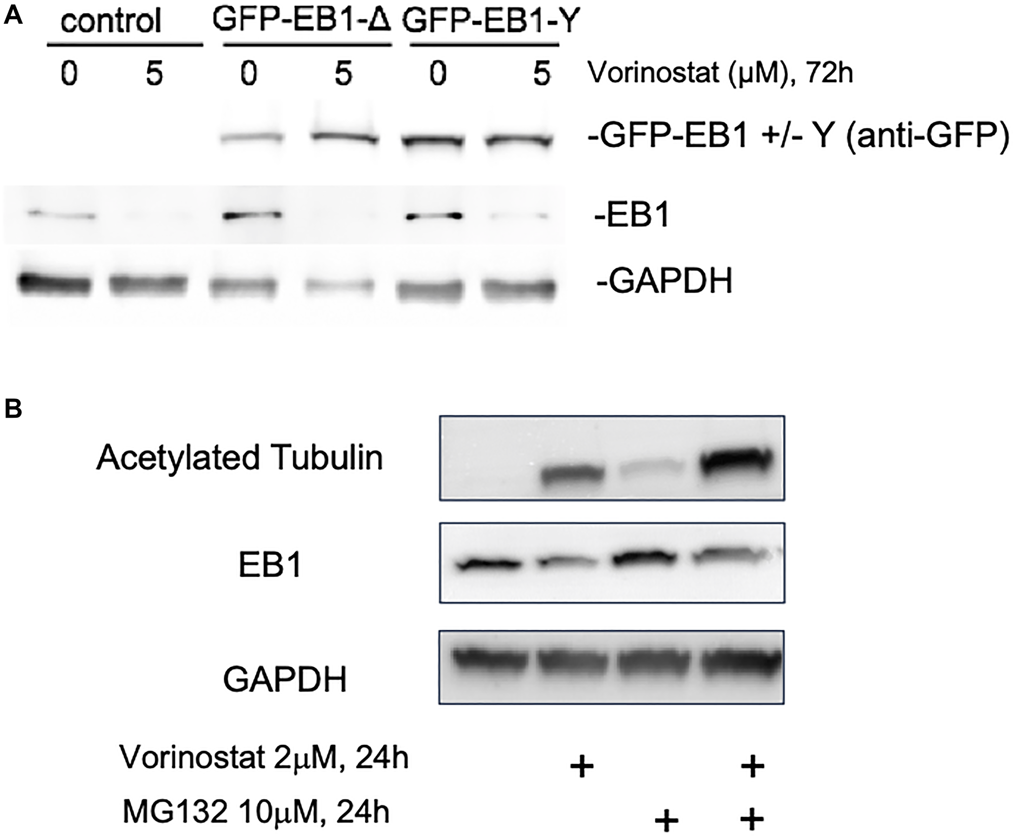 Vorinostat changes U87-MG endogenous EB1 expression but not GFP-EB1.