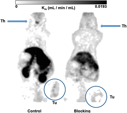 Metabolic trapping rate (Patlak Km) images.