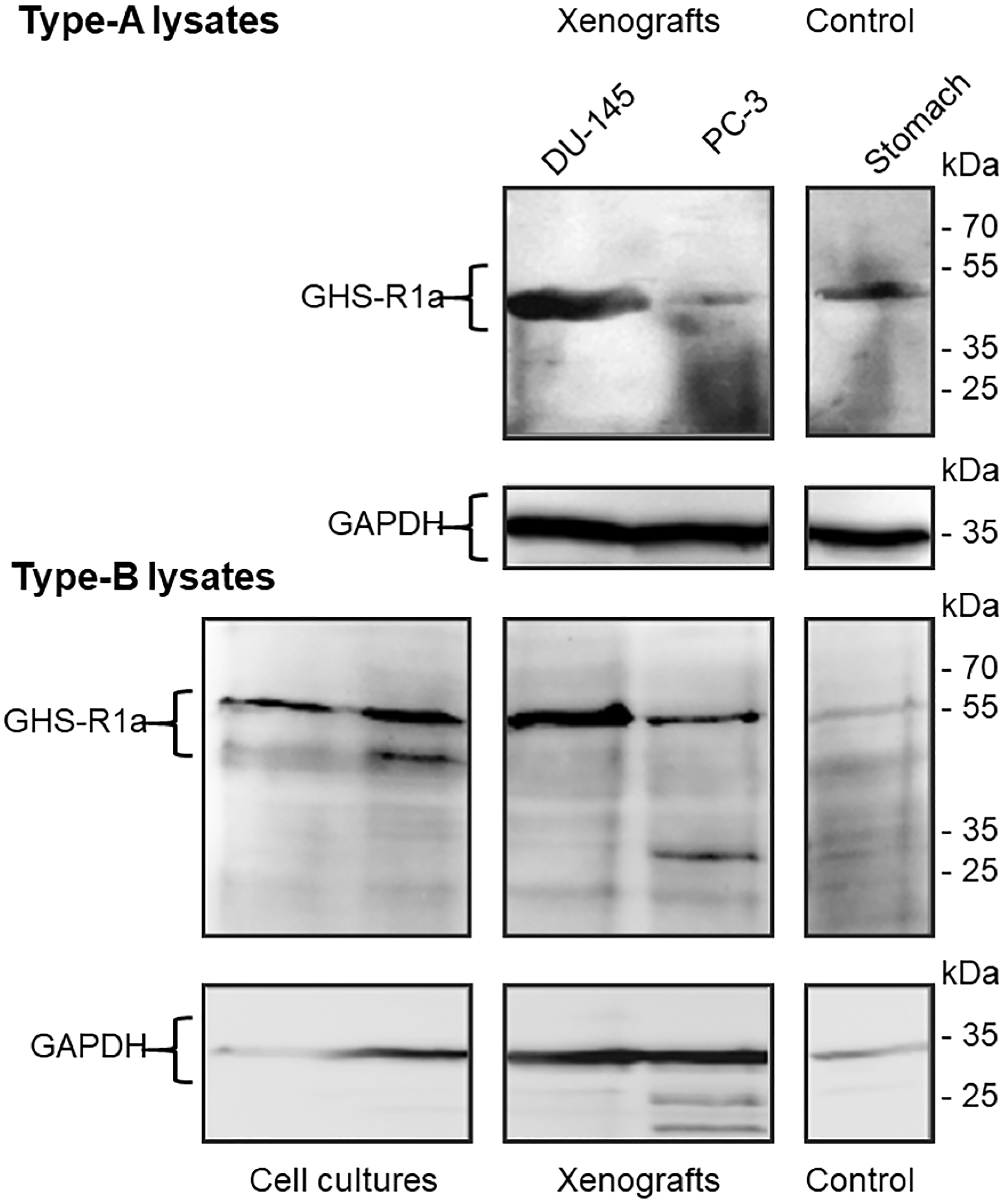 Immunoblots of GHS-R1a in lysates of DU-145 and PC-3 cell cultures, xenografts and Control.