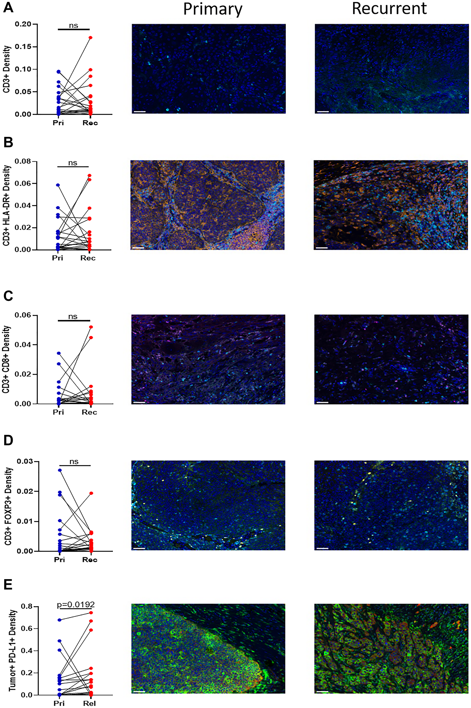 Immunohistochemistry of T cell infiltration into the tumor.