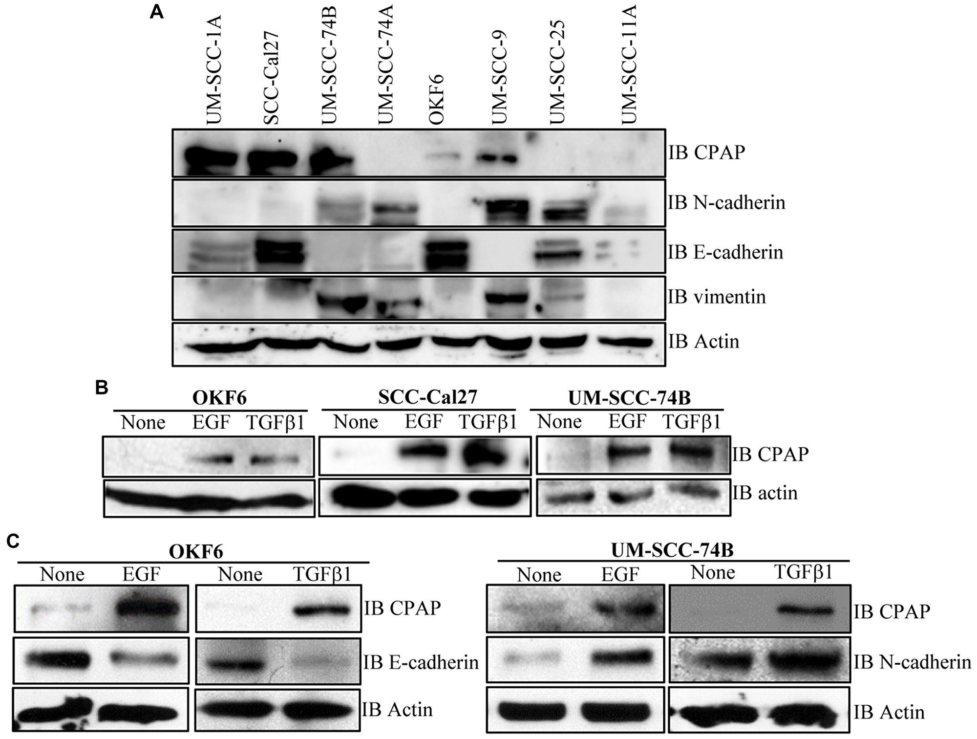 CPAP and EMT marker levels in OSCC and normal cell-lines.