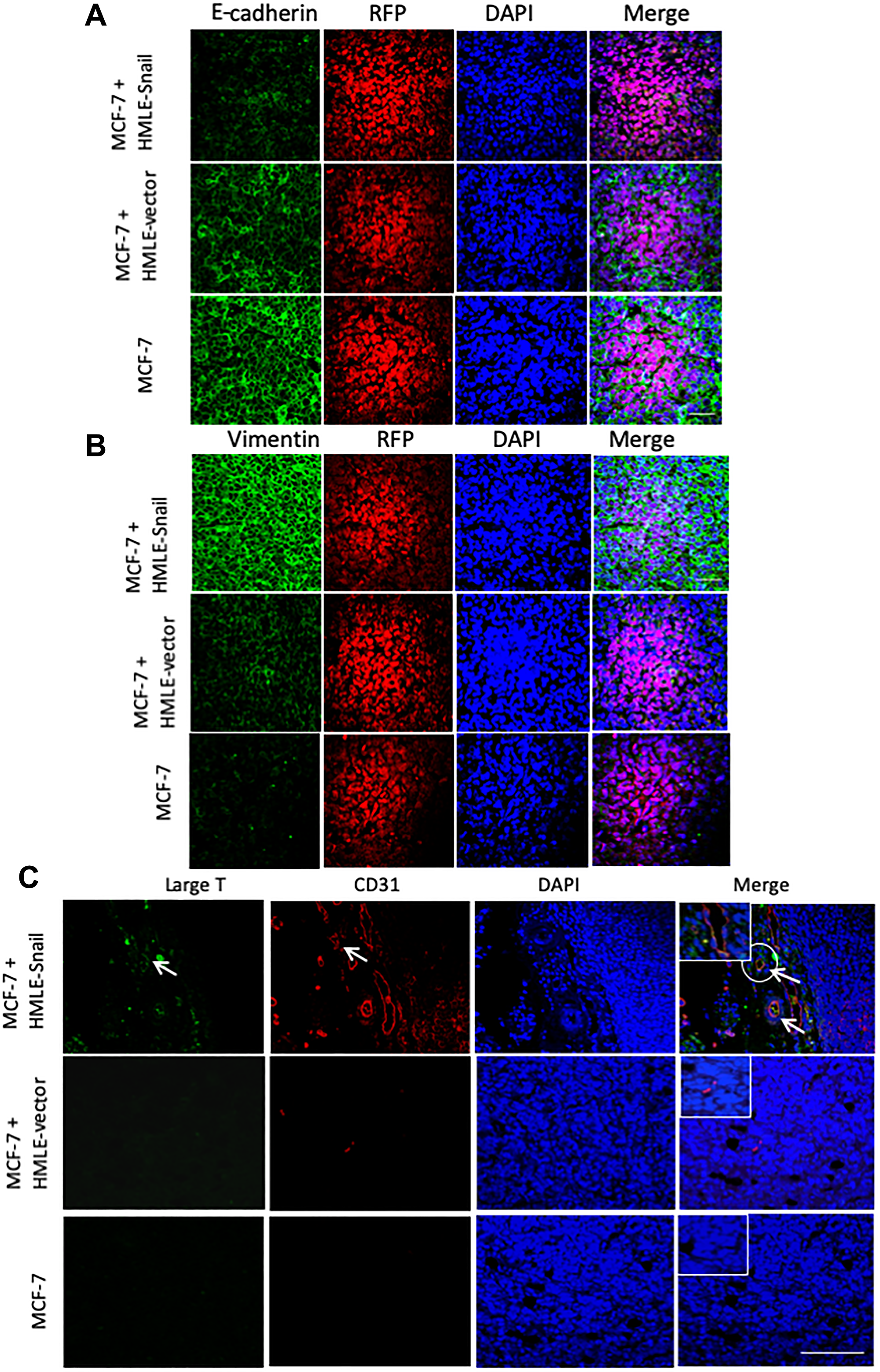 HMLE-Snail cells gain CD31 expression and promote acquisition of mesenchymal traits by admixed MCF-7 cells.