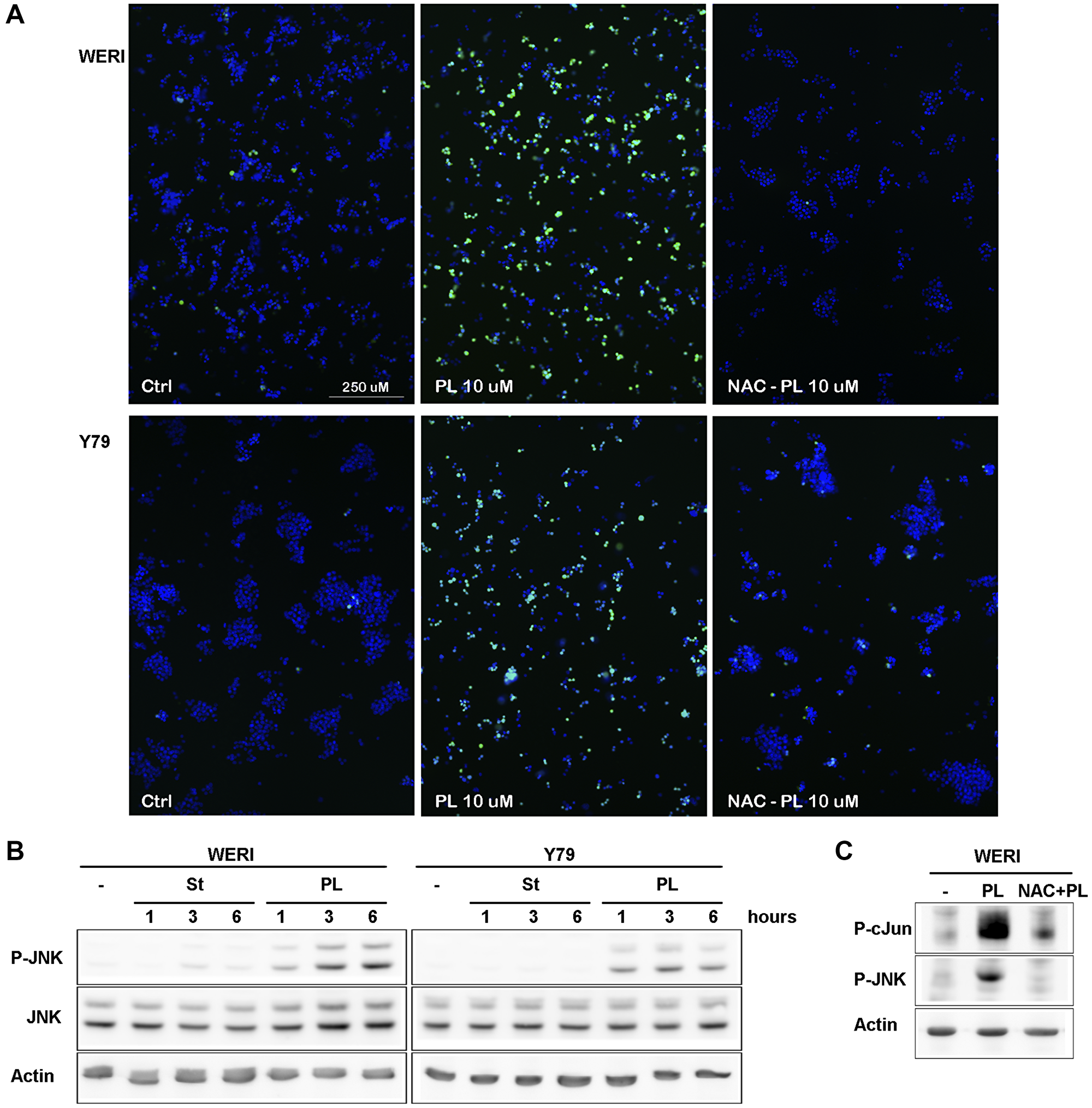 PL induces ROS production in WERI-Rb and Y79 followed by JNK activation.