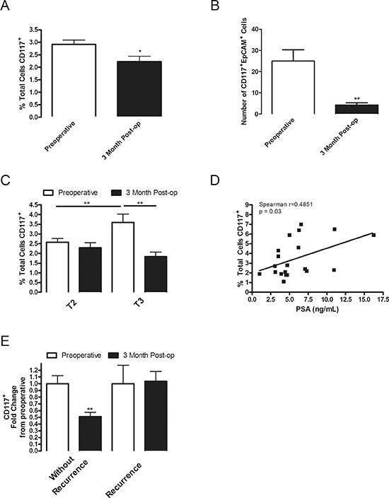 CD117 expression decreases after tumor removal, is dual-positive for EpCAM, increases in high-grade patients and remains elevated in patients with biochemical recurrence.