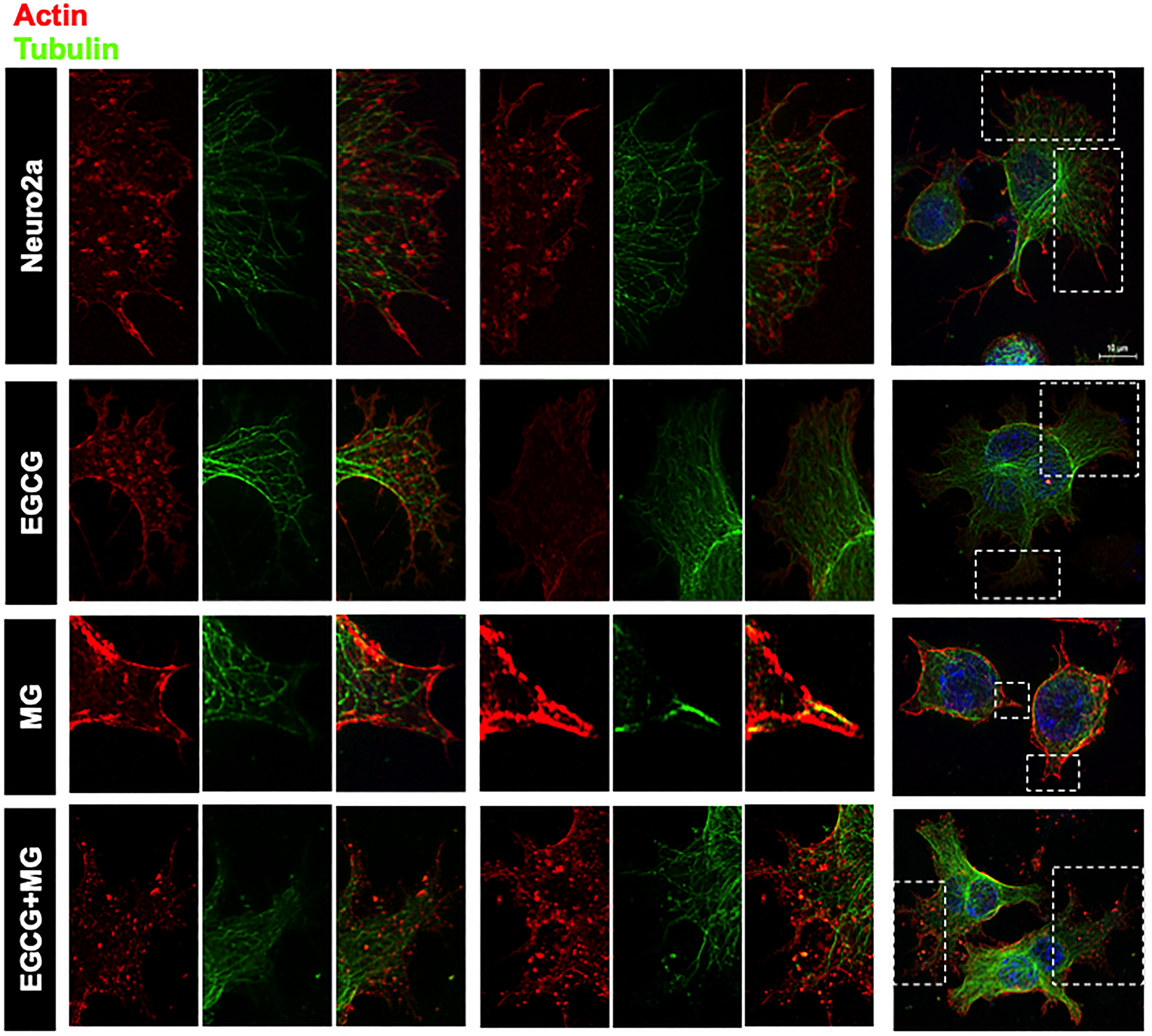 Super-resolution microscopy images for detailed analysis of cytoskeleton.