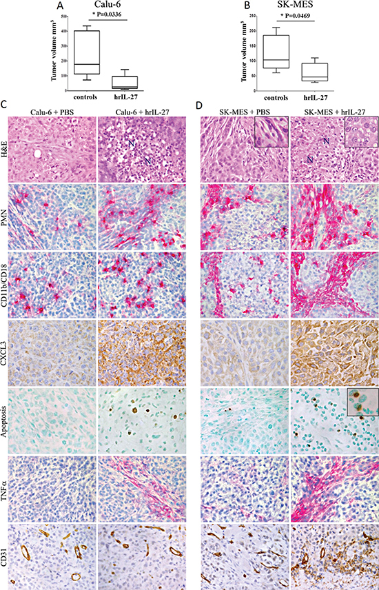 Antitumor Effects of IL-27 in Immunodeficient Pre-Clinical Models of Lung AC and SCC and Histopathological Analyses of the Tumor Growth or Regression Areas.