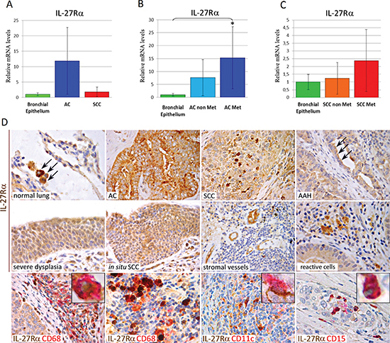 mRNA and Protein Expression of IL-27R&#x03B1; in Human Normal Lung, Pre-Neoplastic Lesions, Lung AC and SCC.