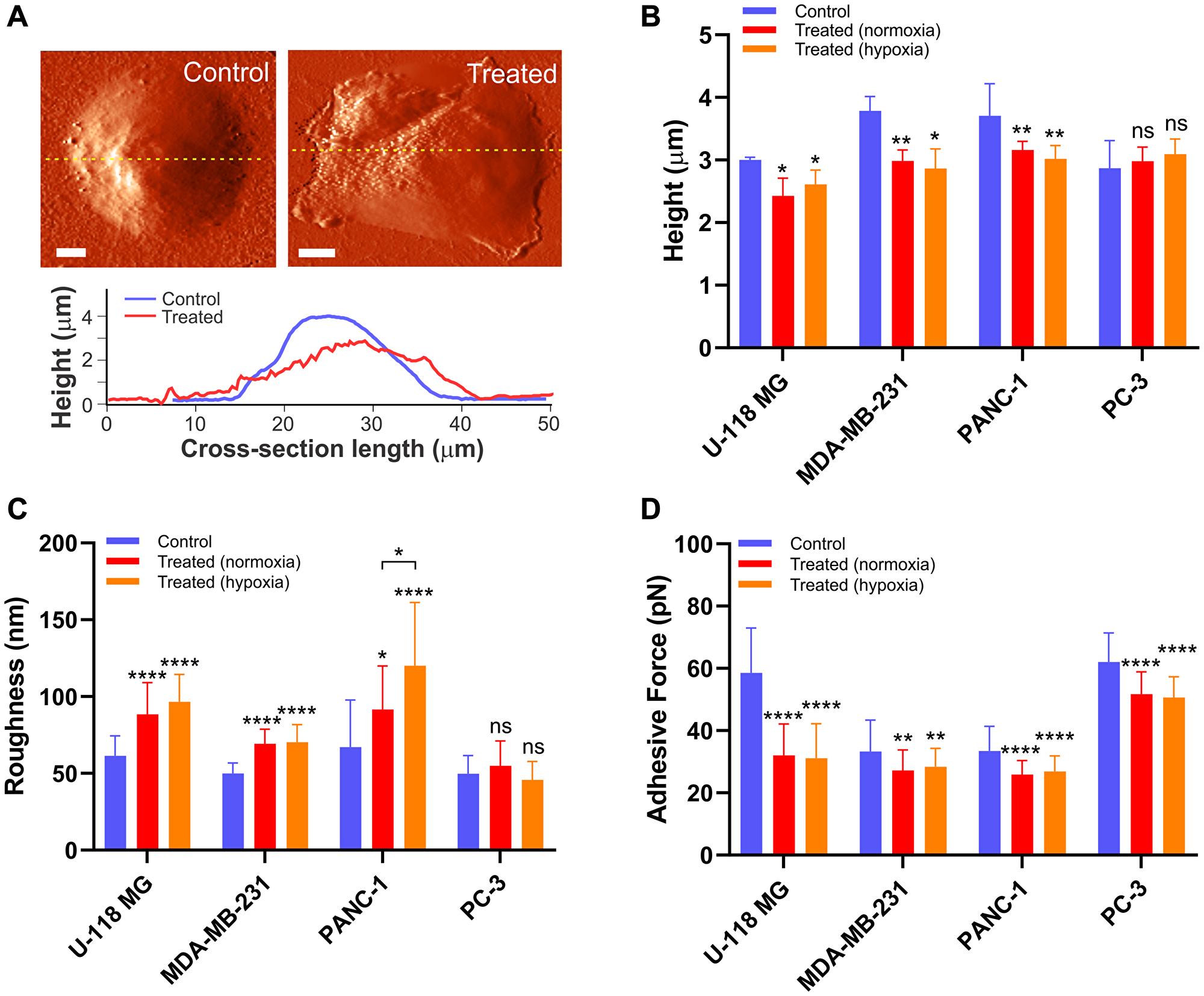 The drug-induced morphological alteration in cancer cells.