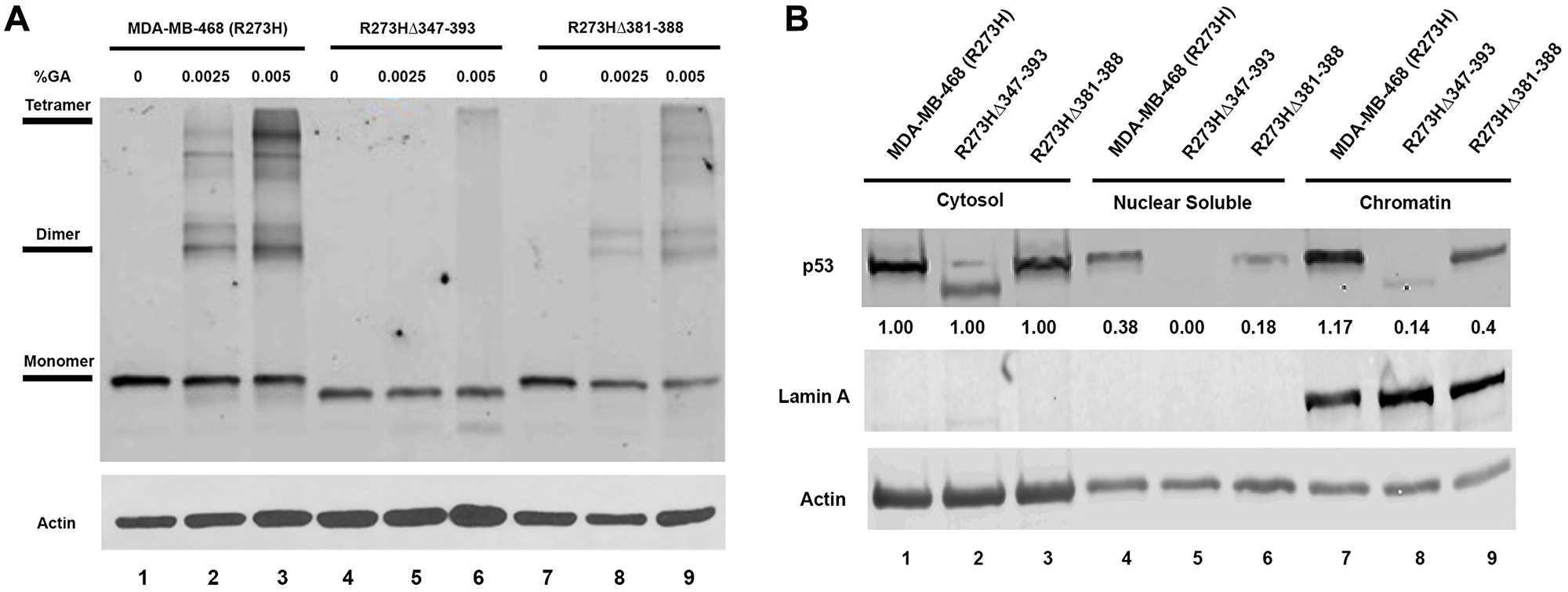 Mutations in the OD of mtp53 destabilize tetramer formation and reduce mtp53 chromatin association.