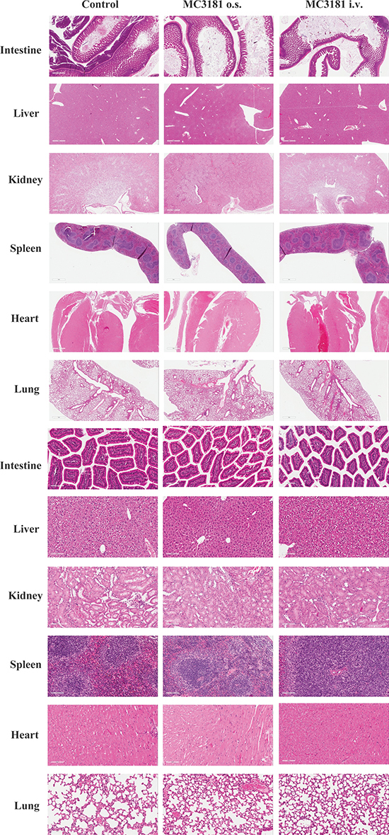 Histological analysis of tissue organs from CD-1 mice after 3 weeks of treatment with MC3181.