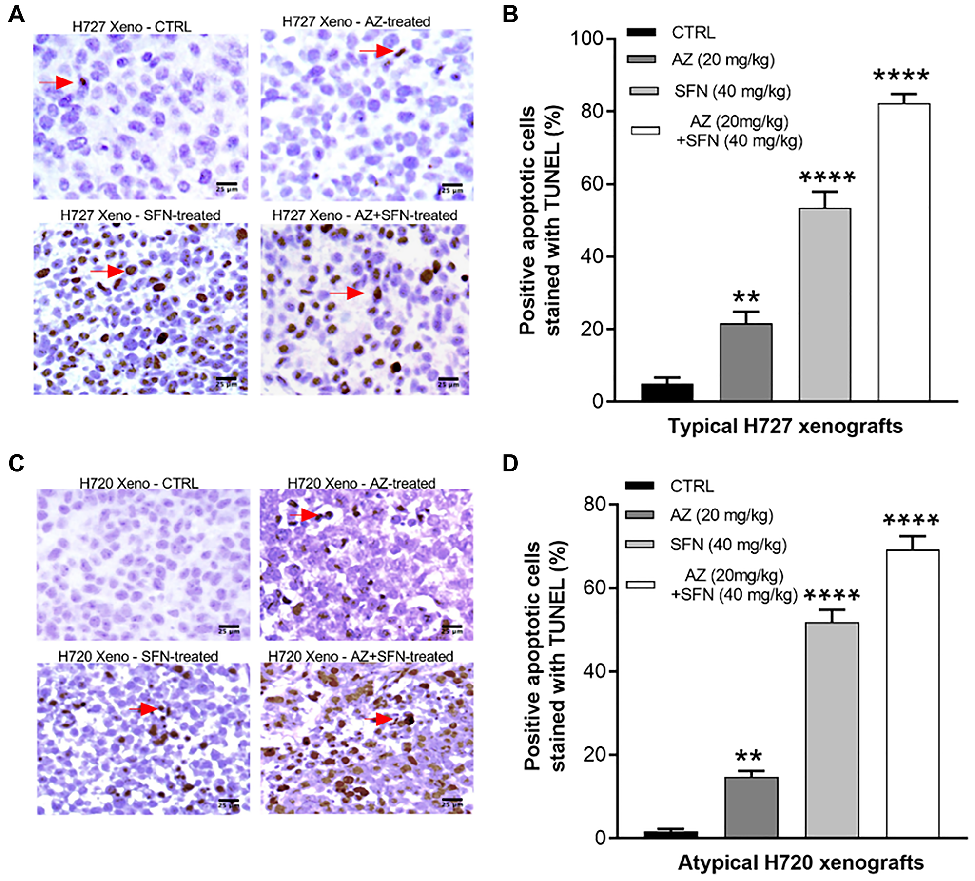 AZ, SFN, and AZ+SFN induce in vivo TUNEL apoptosis in BC xenografts.