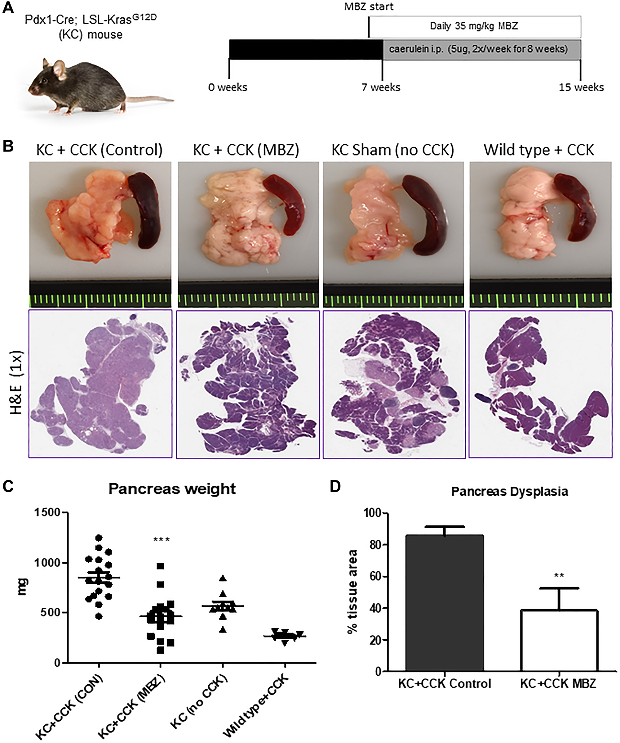 Mebendazole suppressed Kras-mediated, cearulein-induced tumorigenesis in the KC mouse model of pancreatitis.
