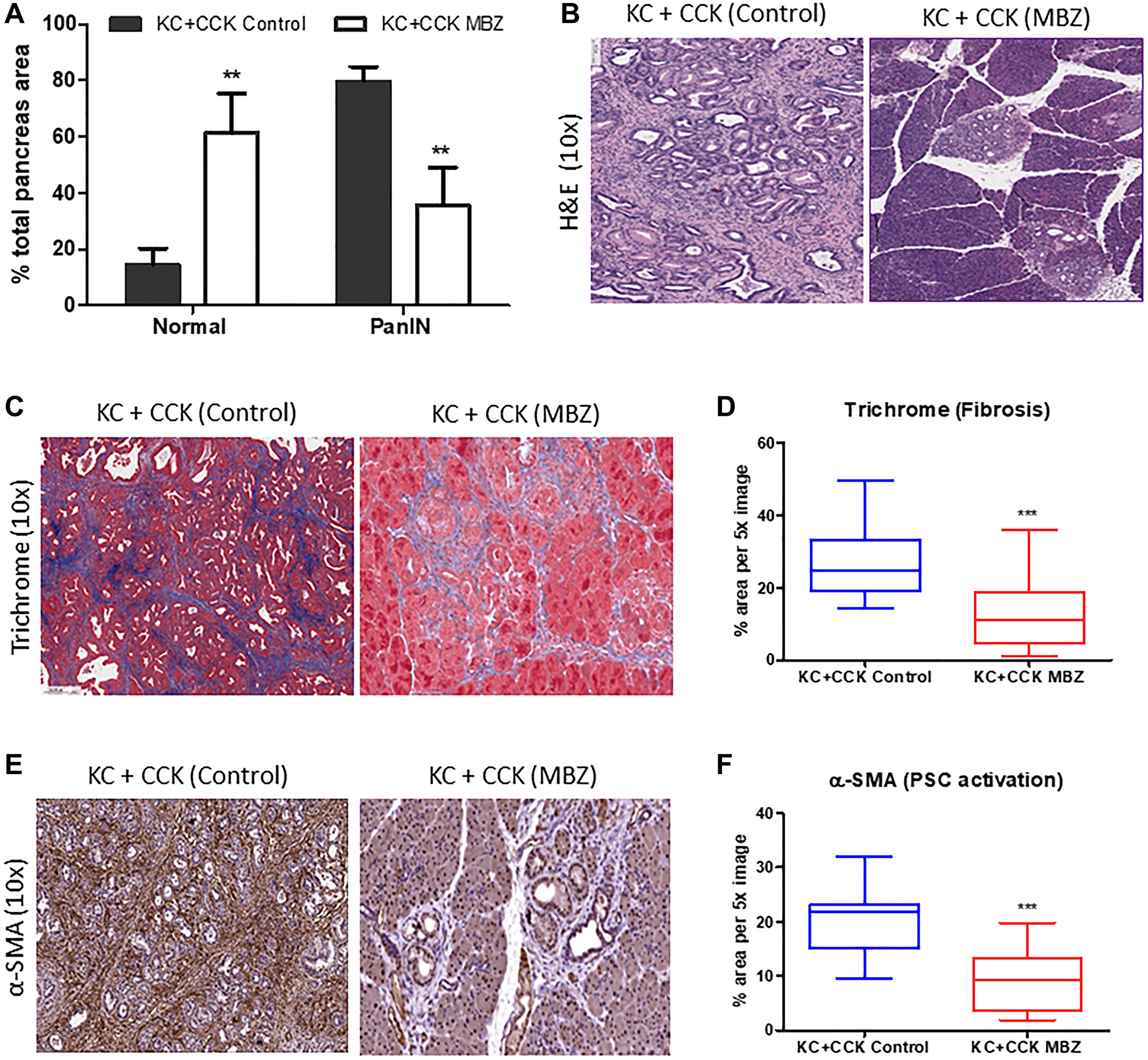 Mebendazole inhibited PanIN formation and stromal desmoplasia under conditions of inflammatory pancreatitis.