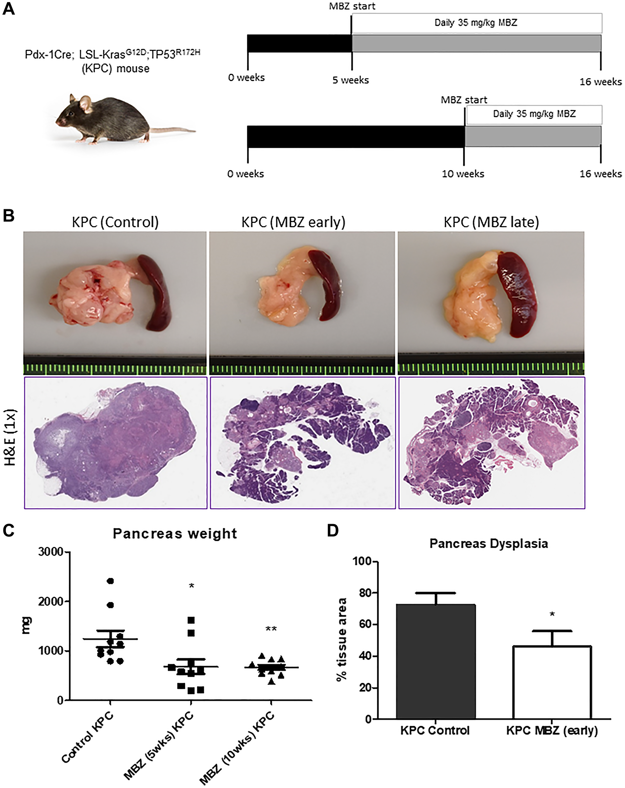 Mebendazole suppressed pancreatic tumor progression and incidence in the KPC mouse as an early and late intervention agent.