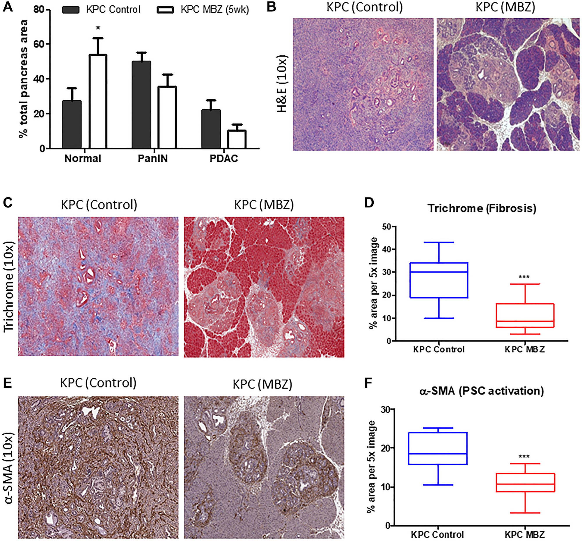 Mebendazole reduced areas of PanIN and PDAC formation and stromal desmoplasia in an aggressive model of pancreatic cancer.