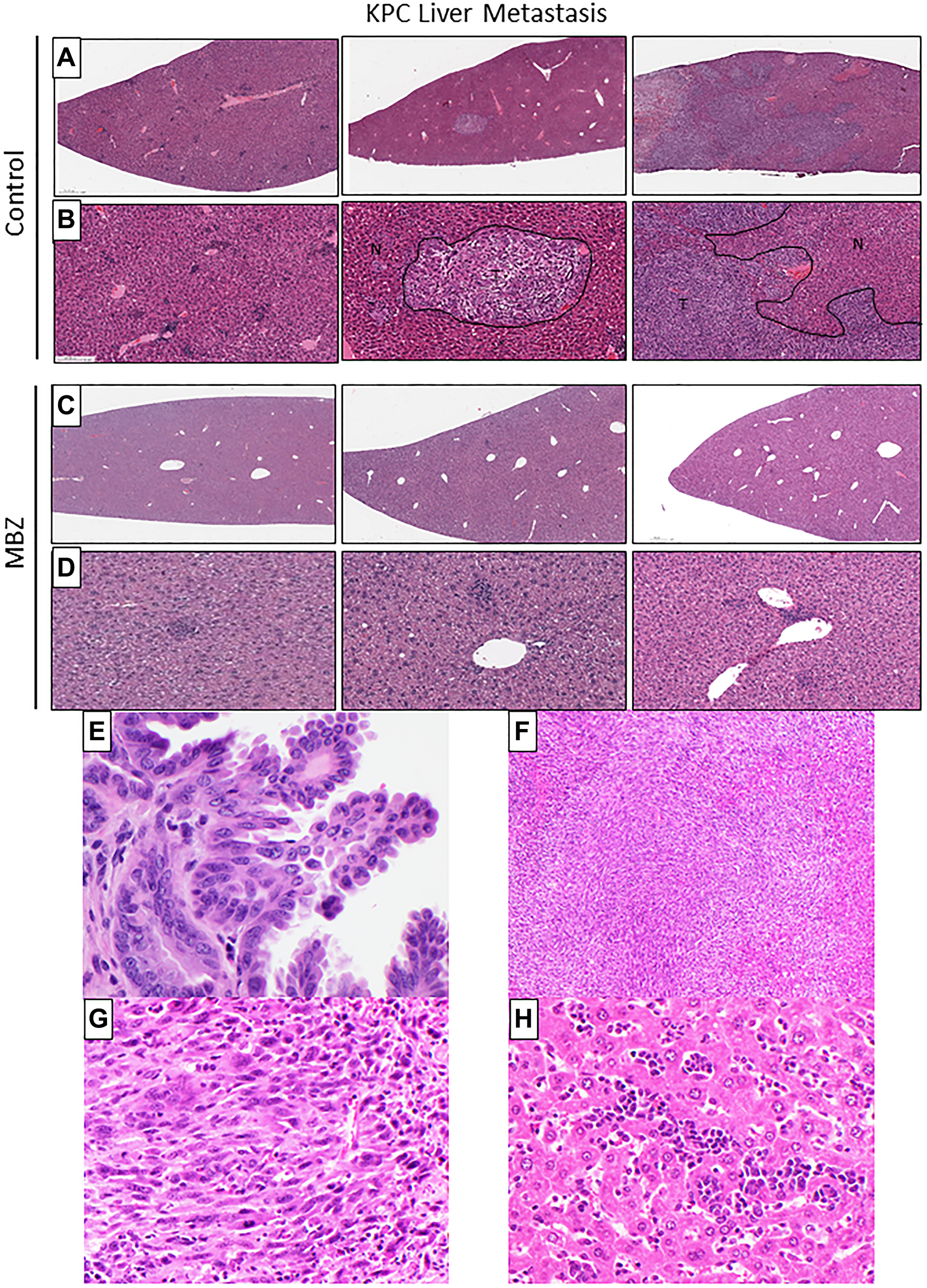 Mebendazole reduced the severity and incidence of liver metastasis in KPC mice when administered as an early intervention.