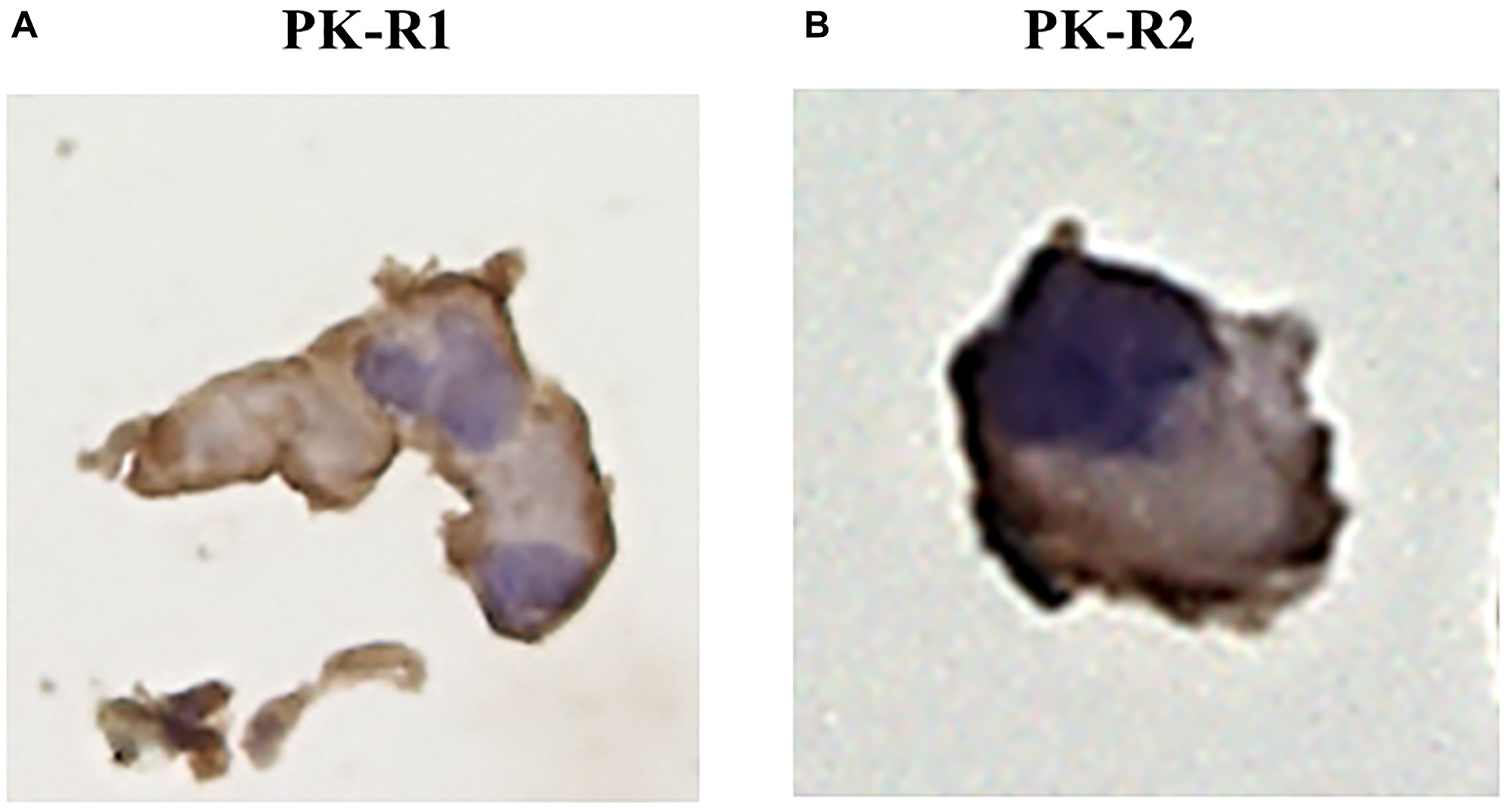 The expression of PK-R proteins in a human lymphatic endothelial cell line by immunohistochemical staining with anti- PK-R1 or PK-R2 mAb.