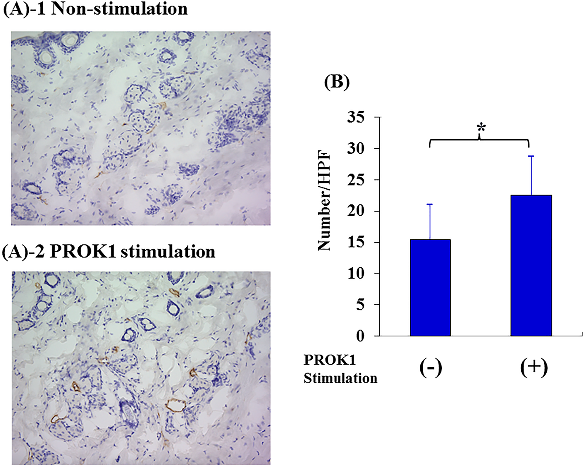 Investigation of Subcutaneous lymphangiogenesis by PROK1 protein.